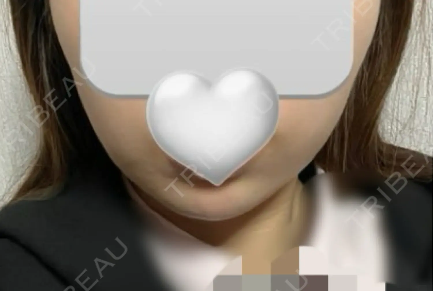 施術後の写真