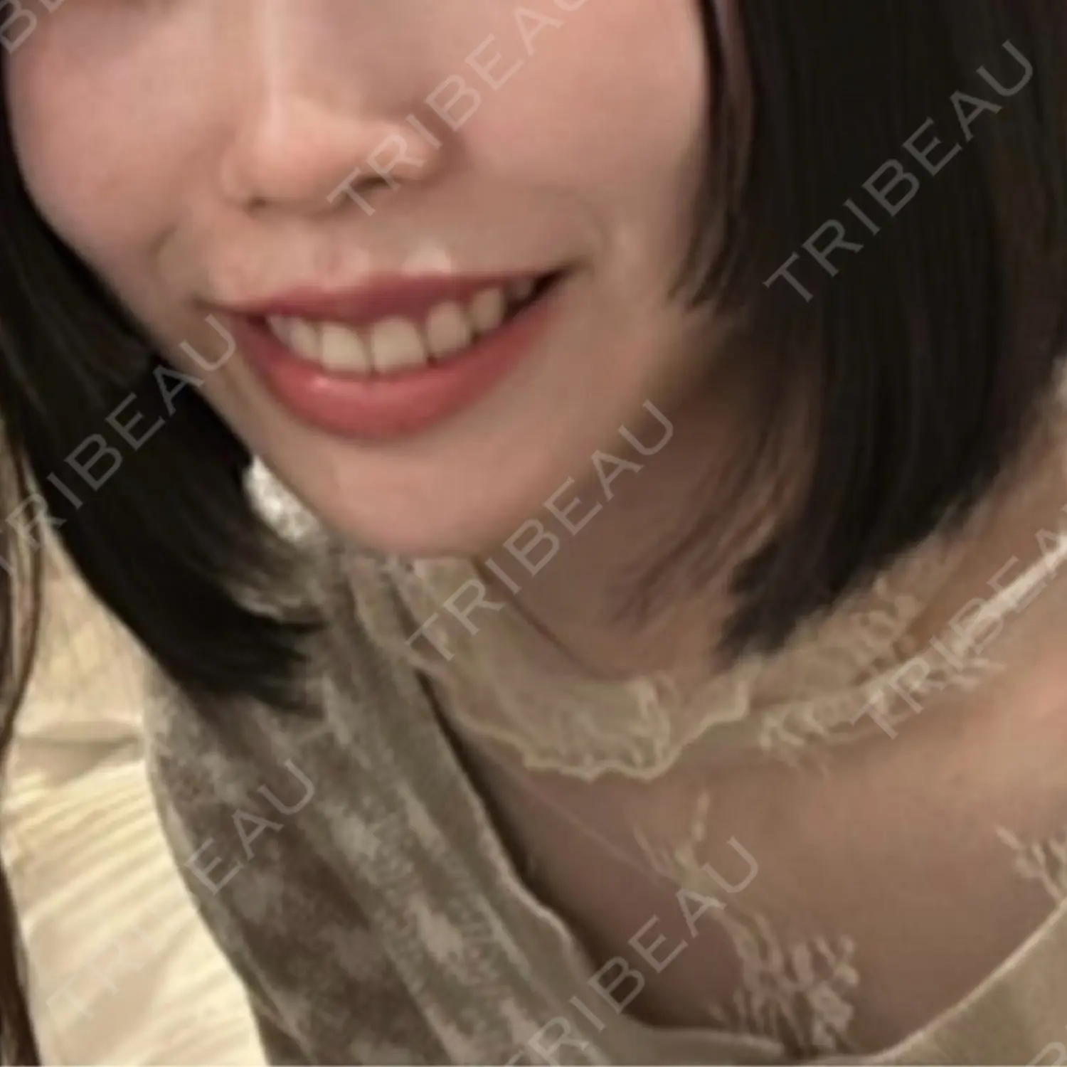 施術後の写真