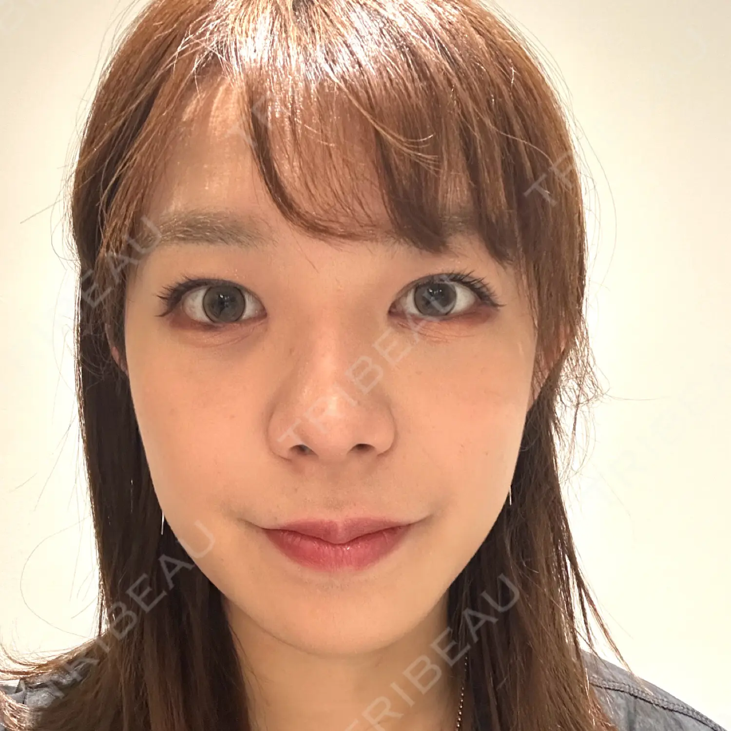 施術後の写真