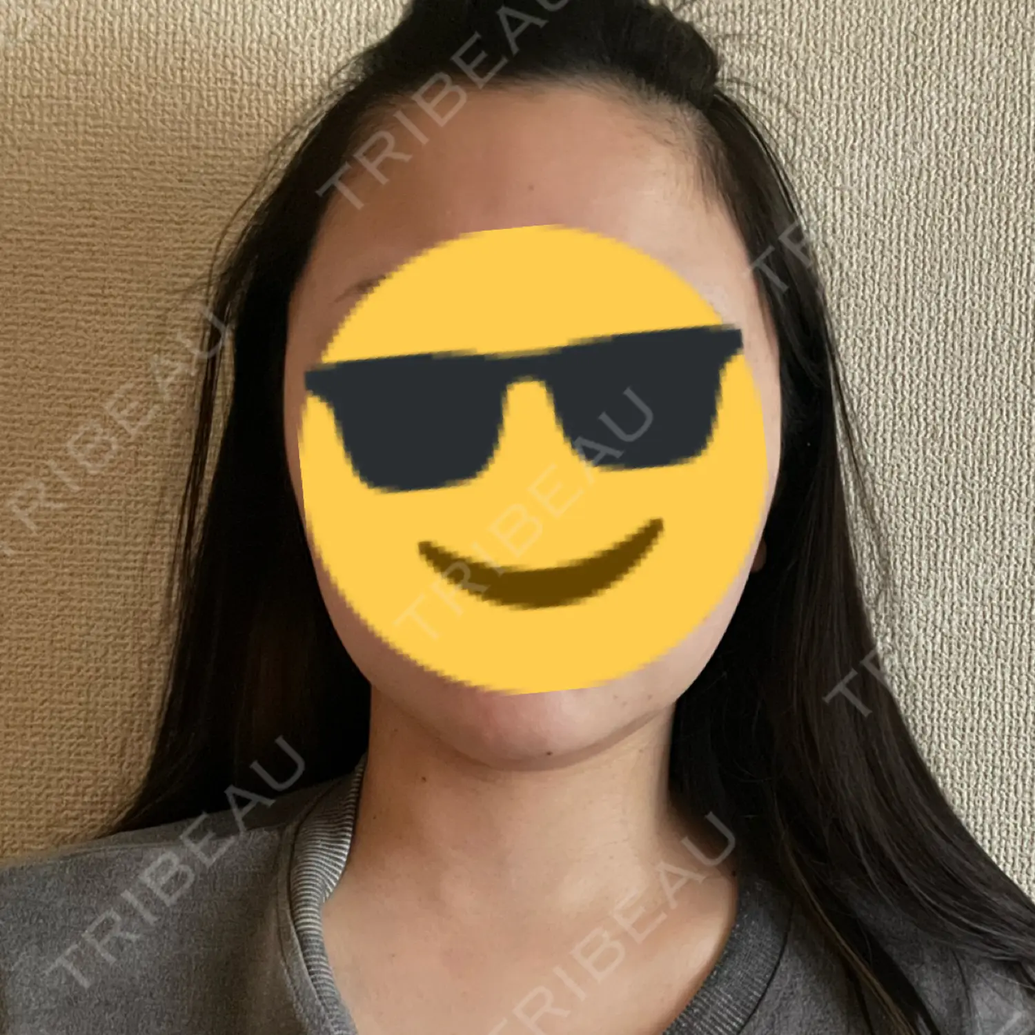 施術後の写真
