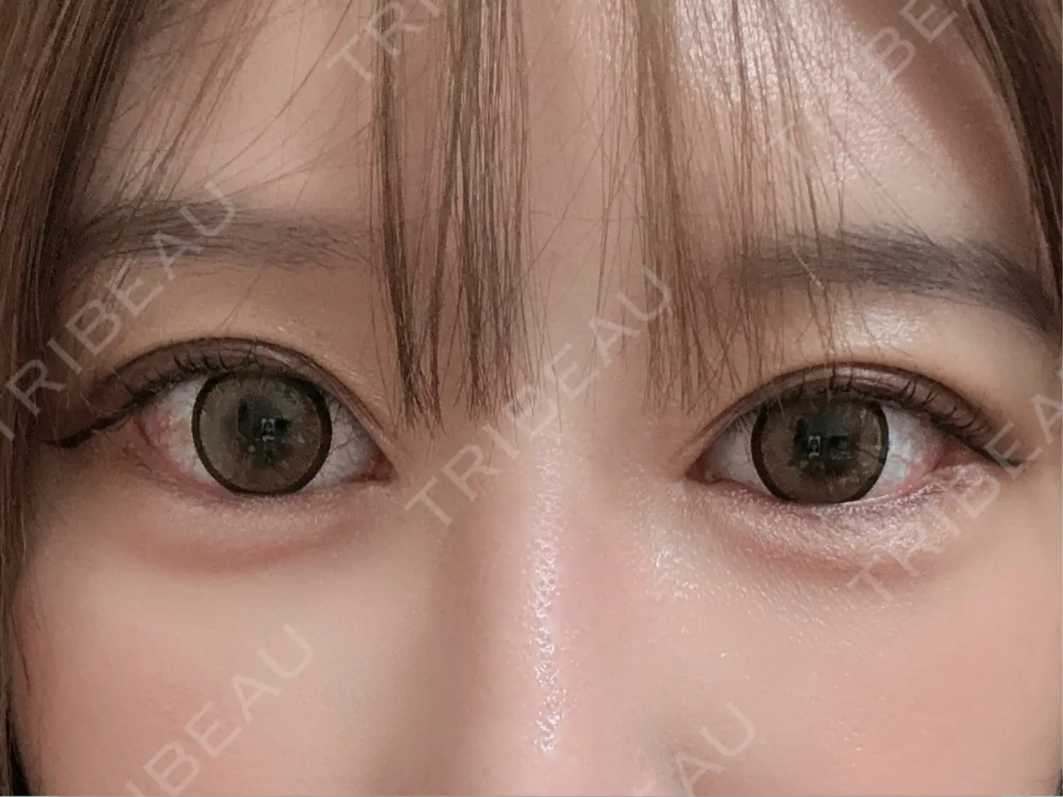 施術後の写真