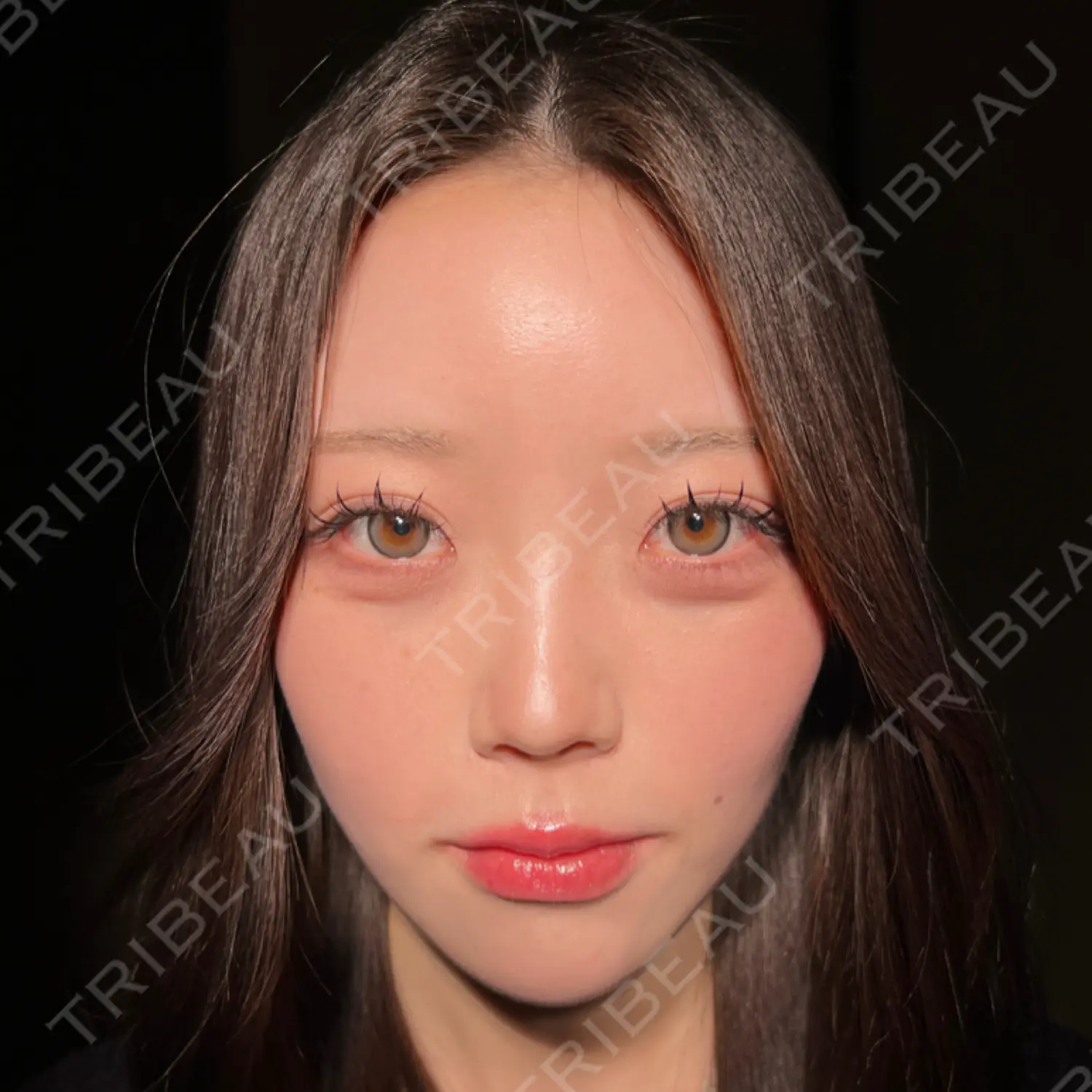 施術後の写真