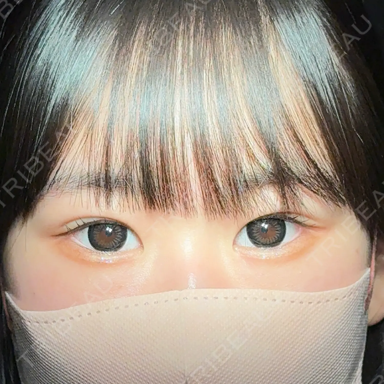 施術後の写真