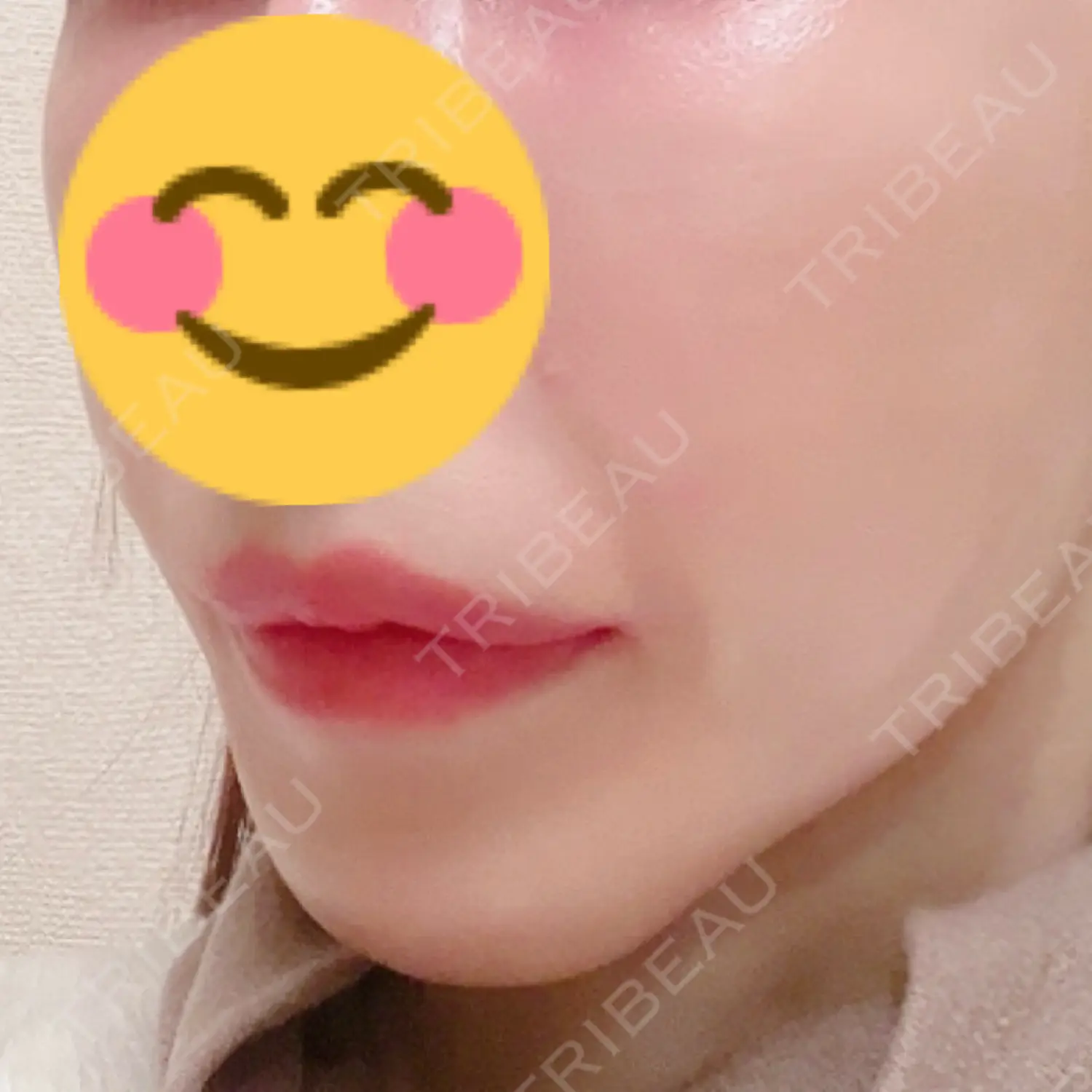 施術後の写真