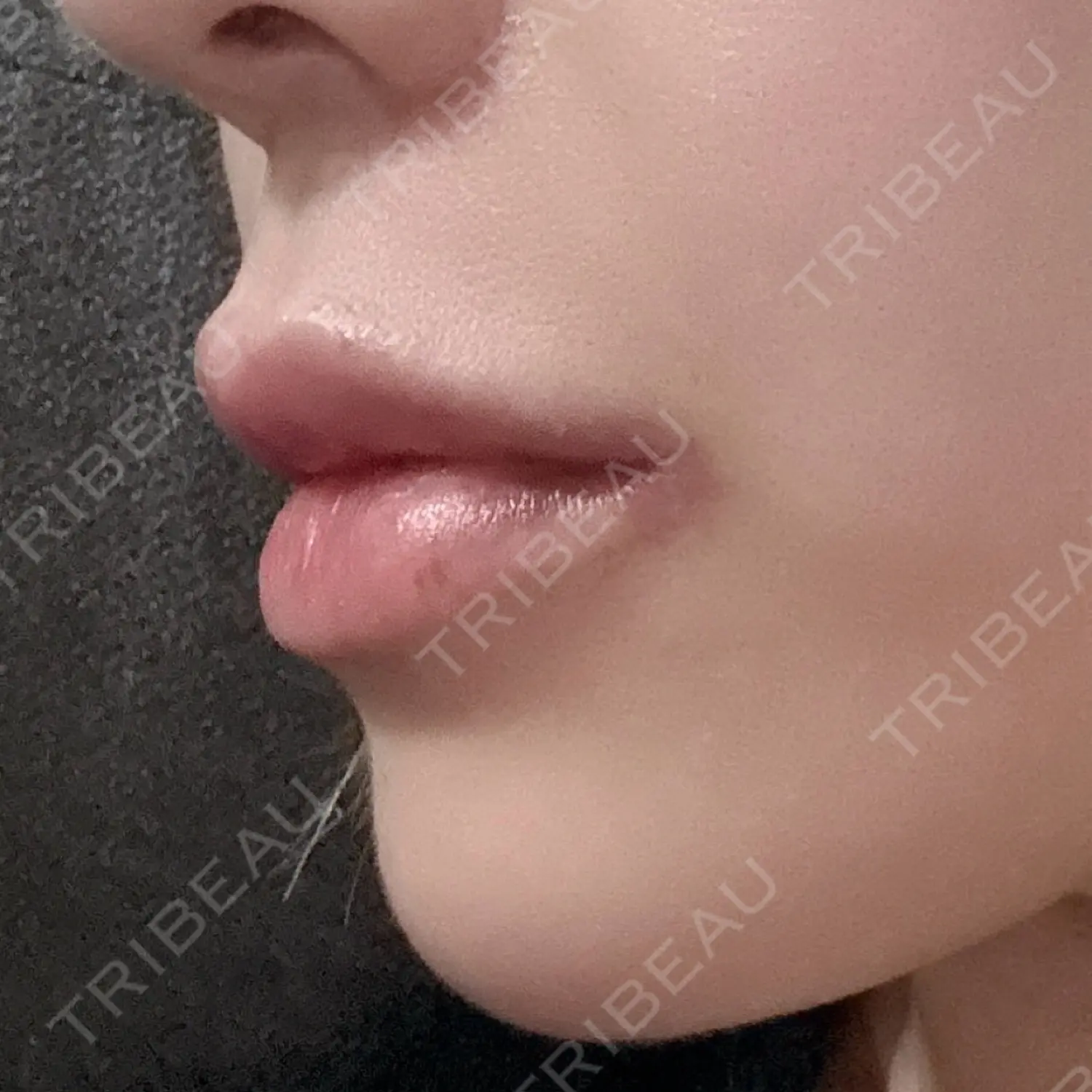 施術後の写真