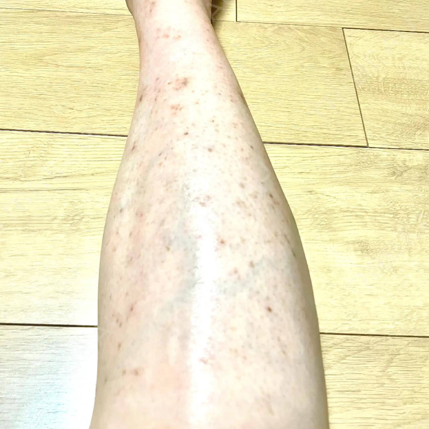 施術後の写真