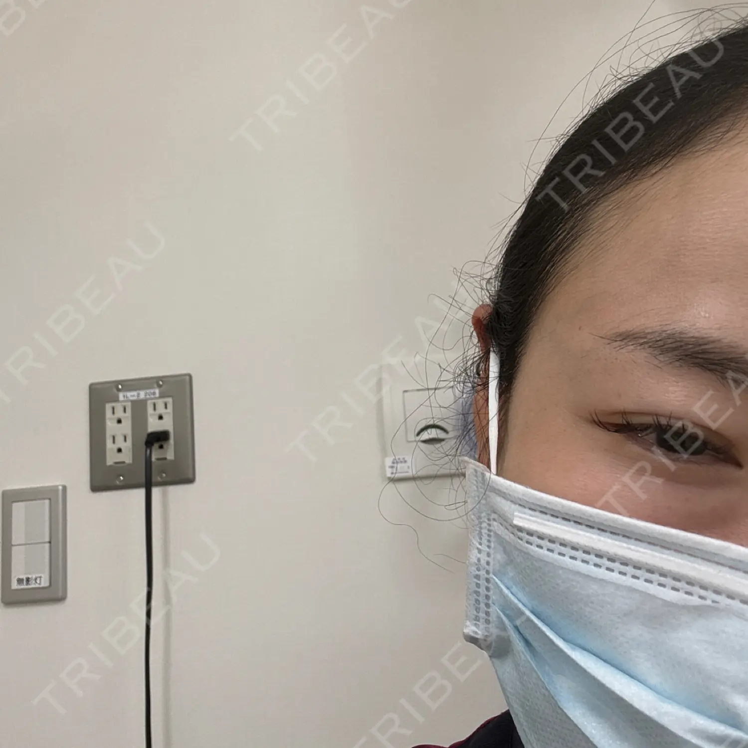 施術後の写真