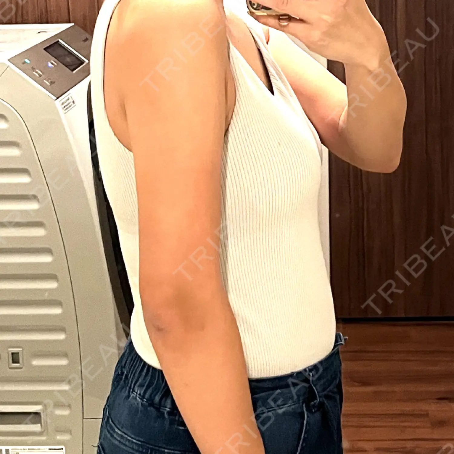 施術後の写真