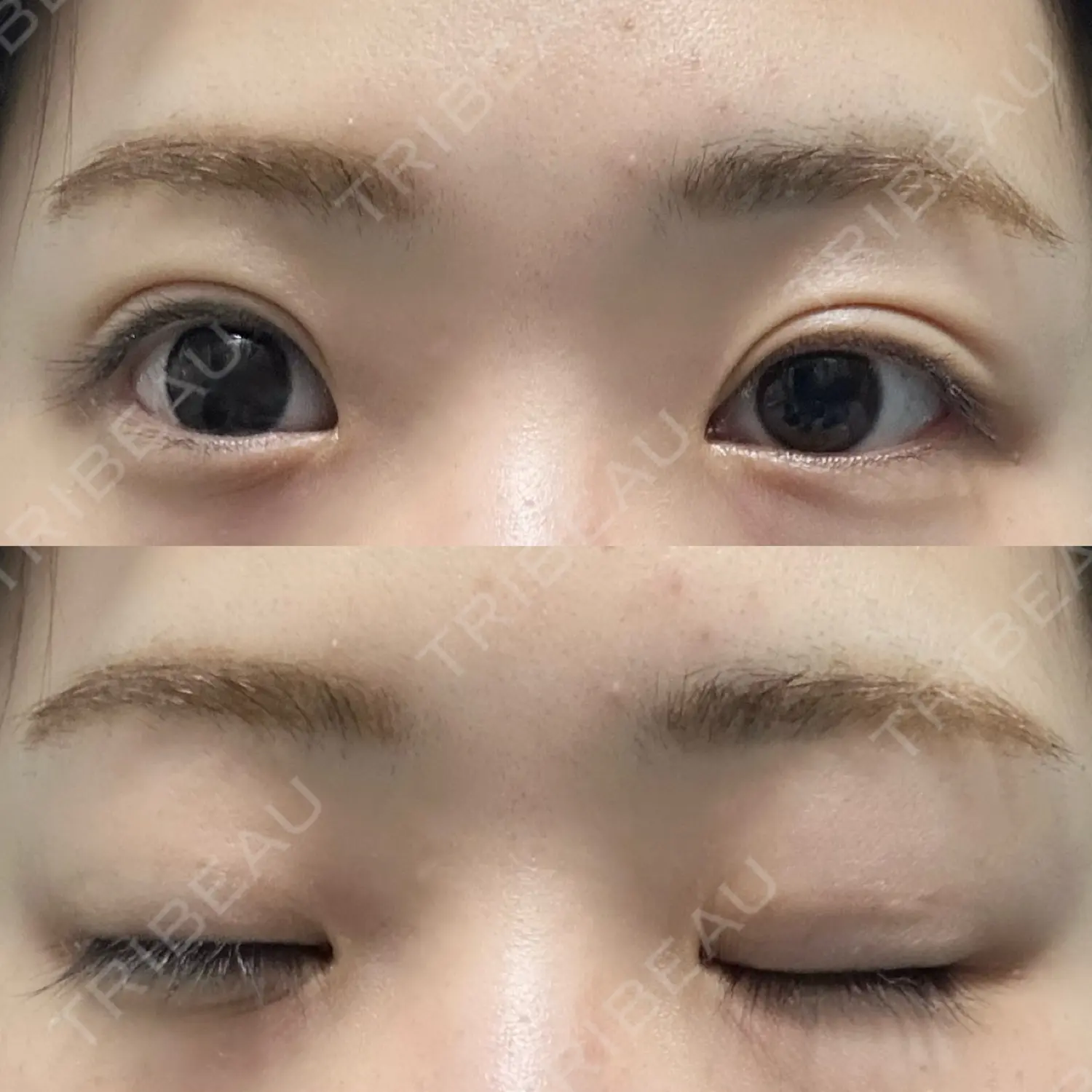 施術後の写真