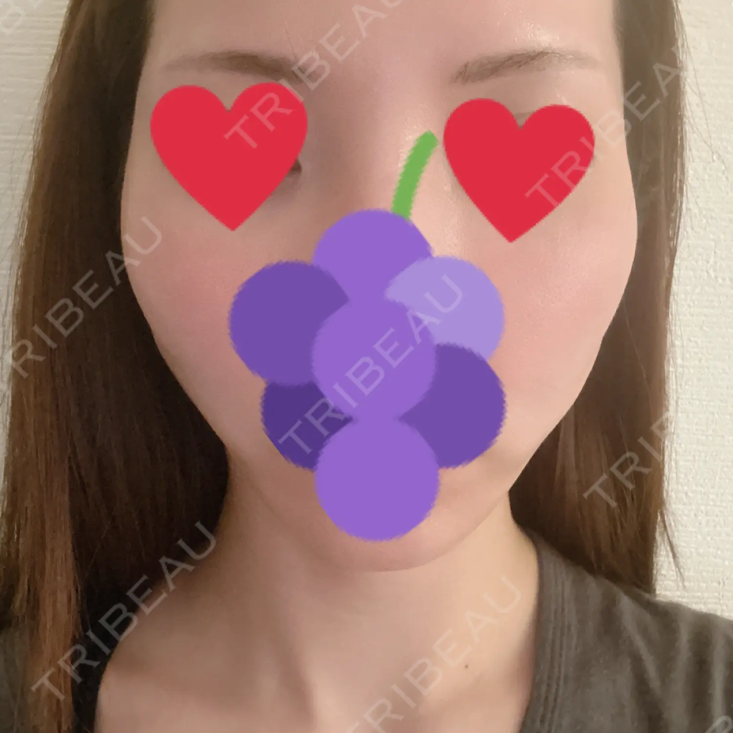 施術後の写真