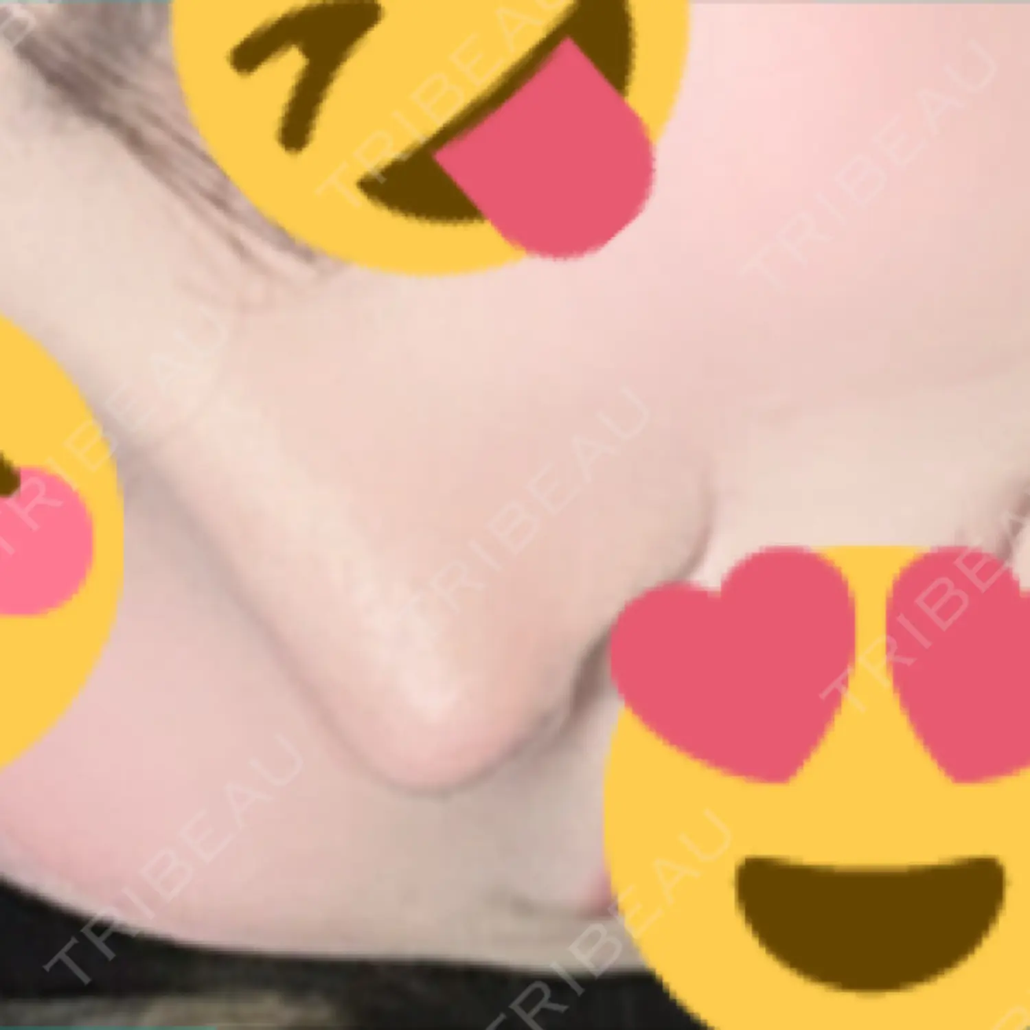 施術後の写真
