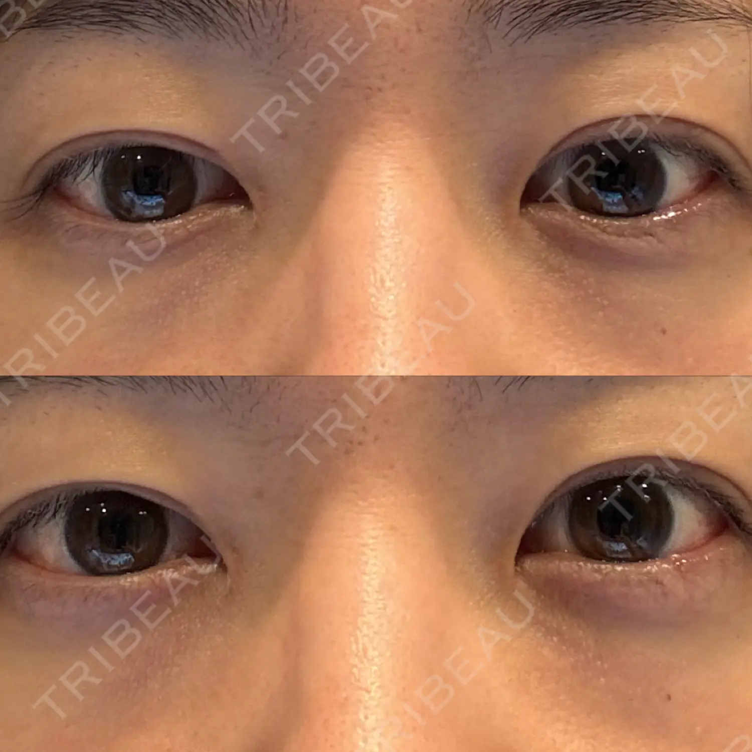 施術後の写真