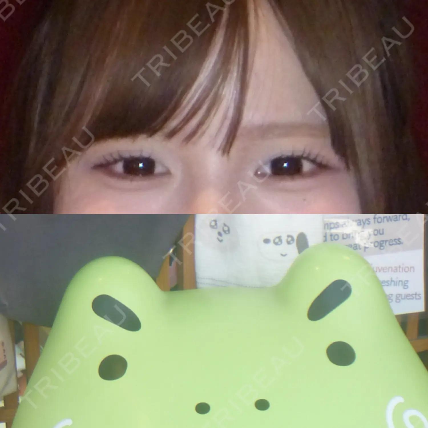 施術後の写真
