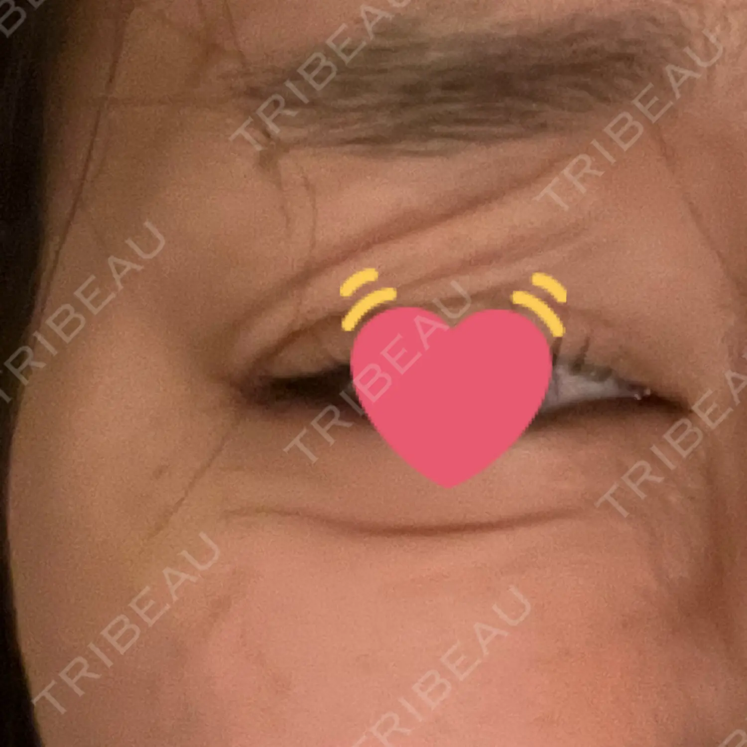 施術後の写真