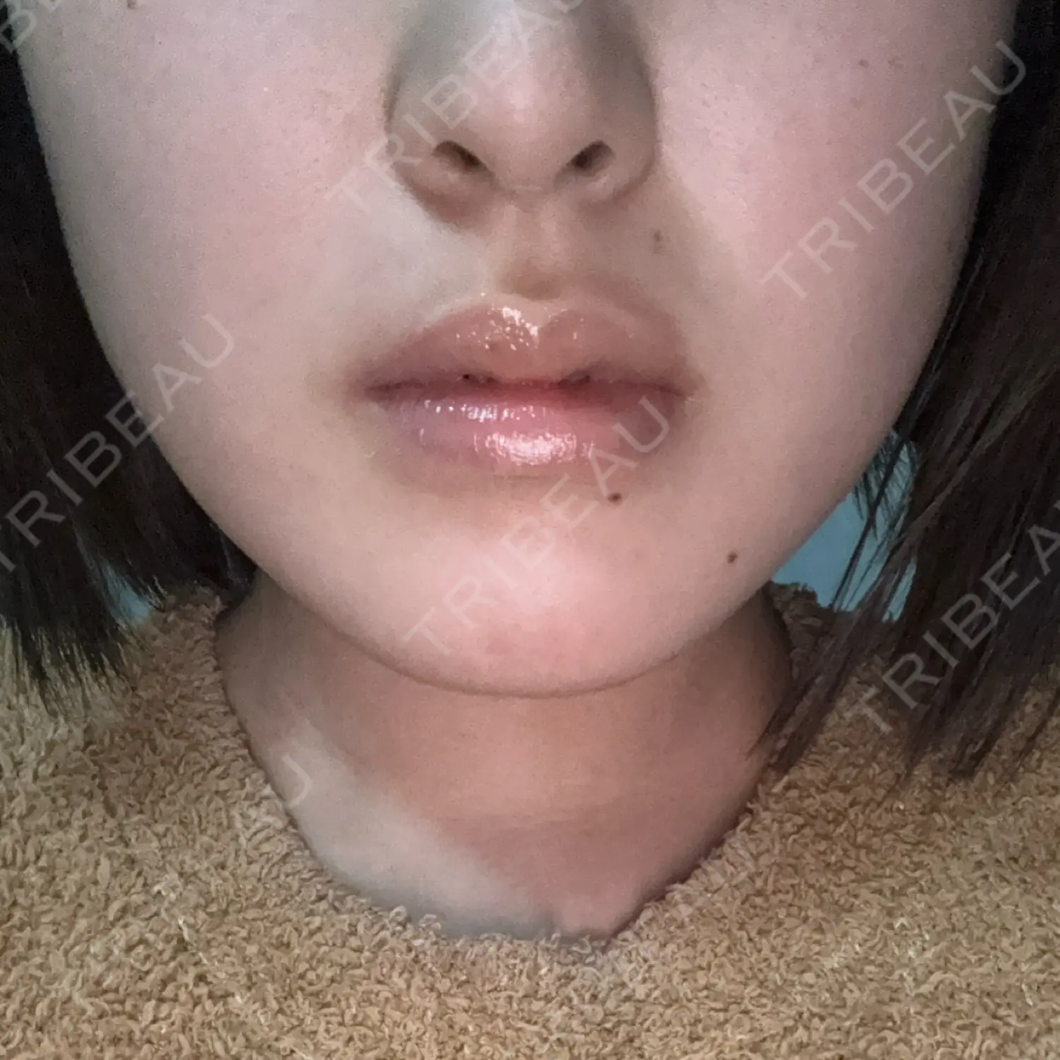 施術後の写真