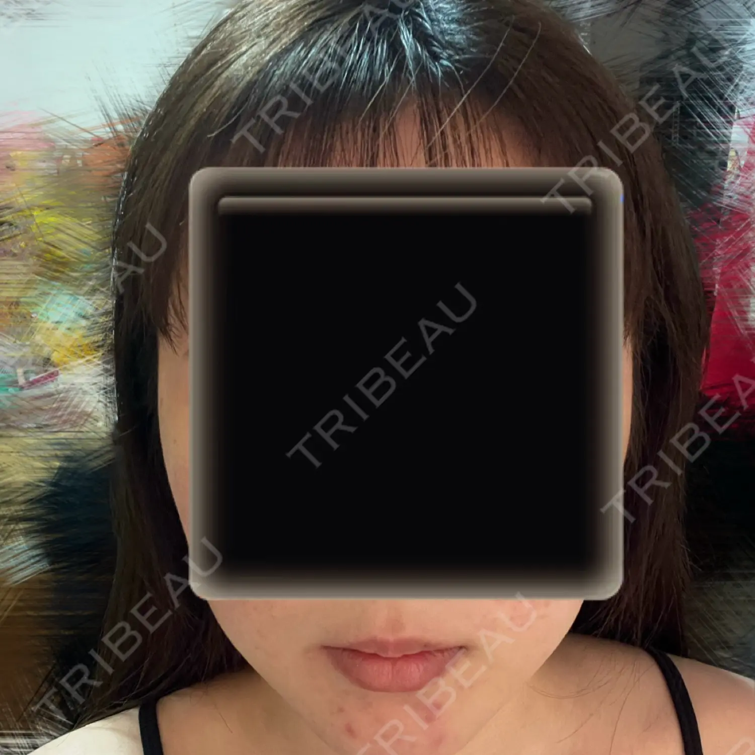 施術後の写真