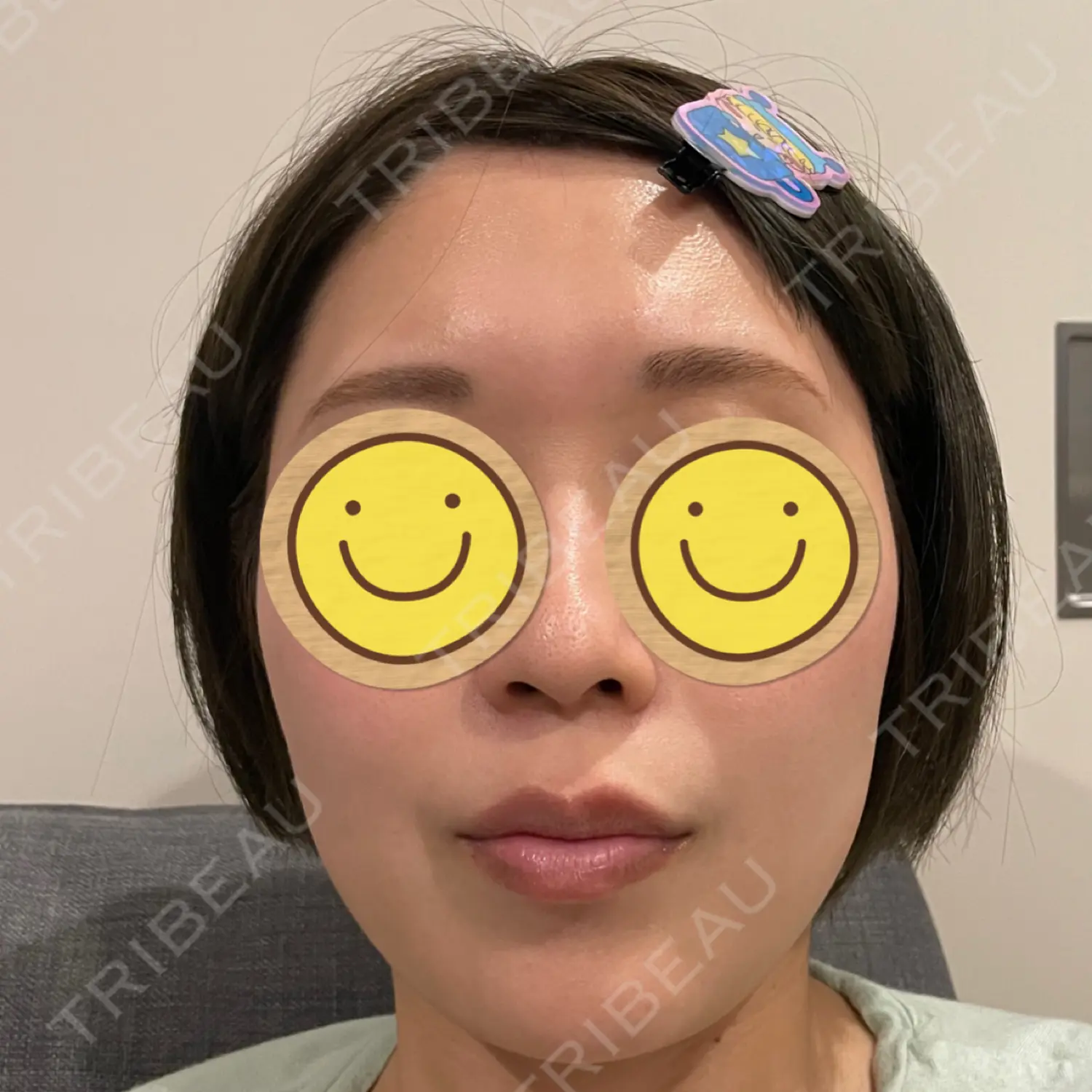 施術後の写真