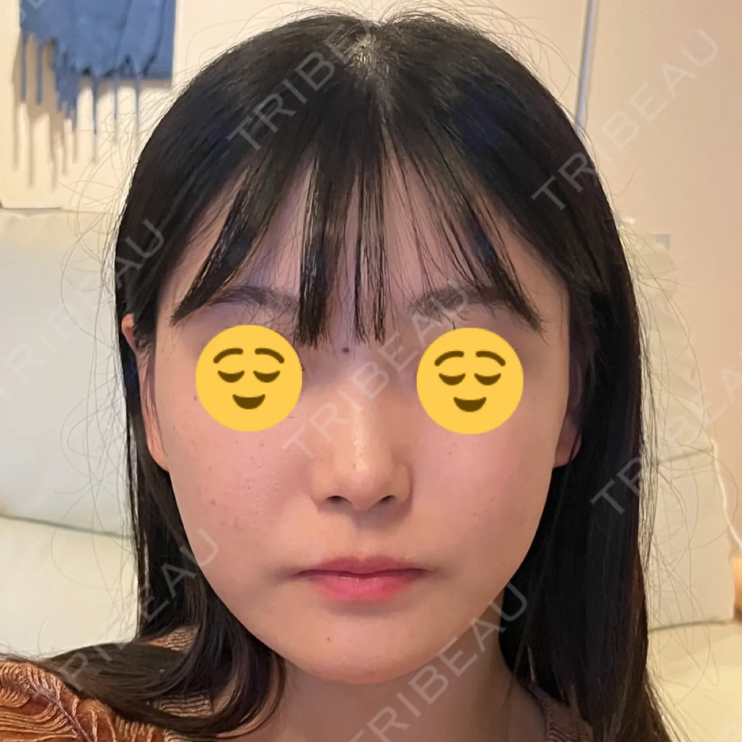 施術後の写真