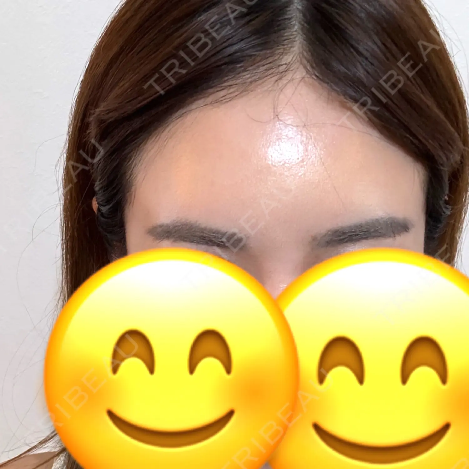 施術後の写真