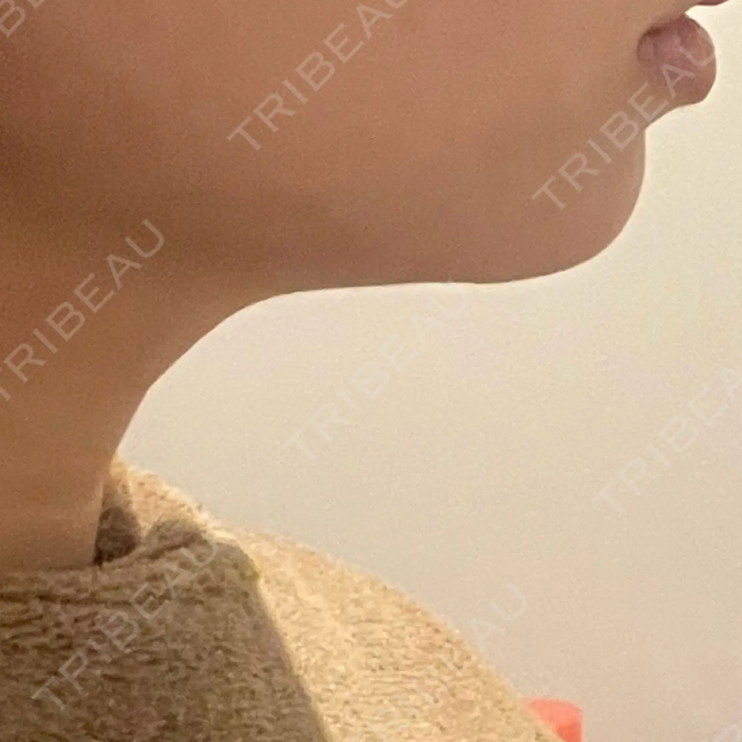 施術後の写真