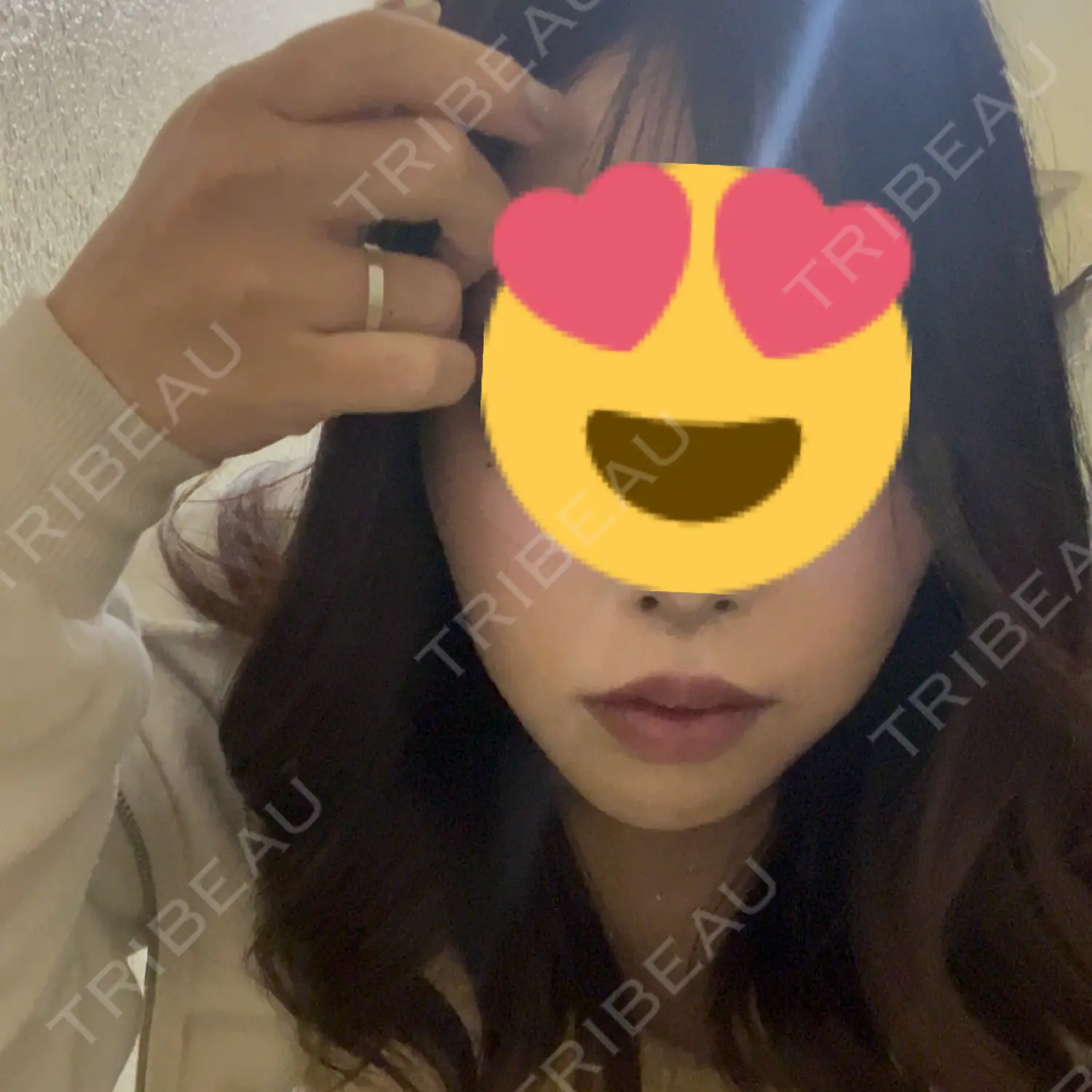 施術後の写真