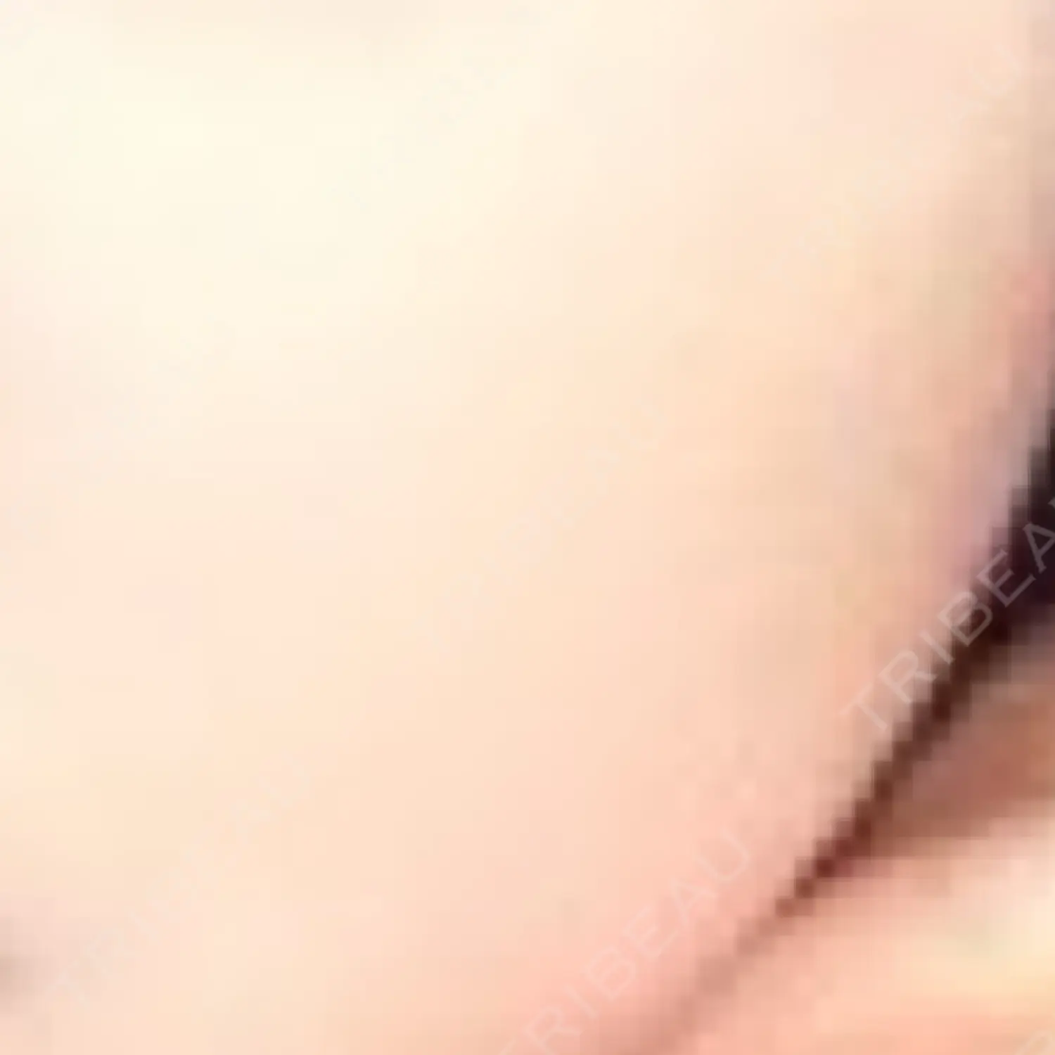 施術後の写真