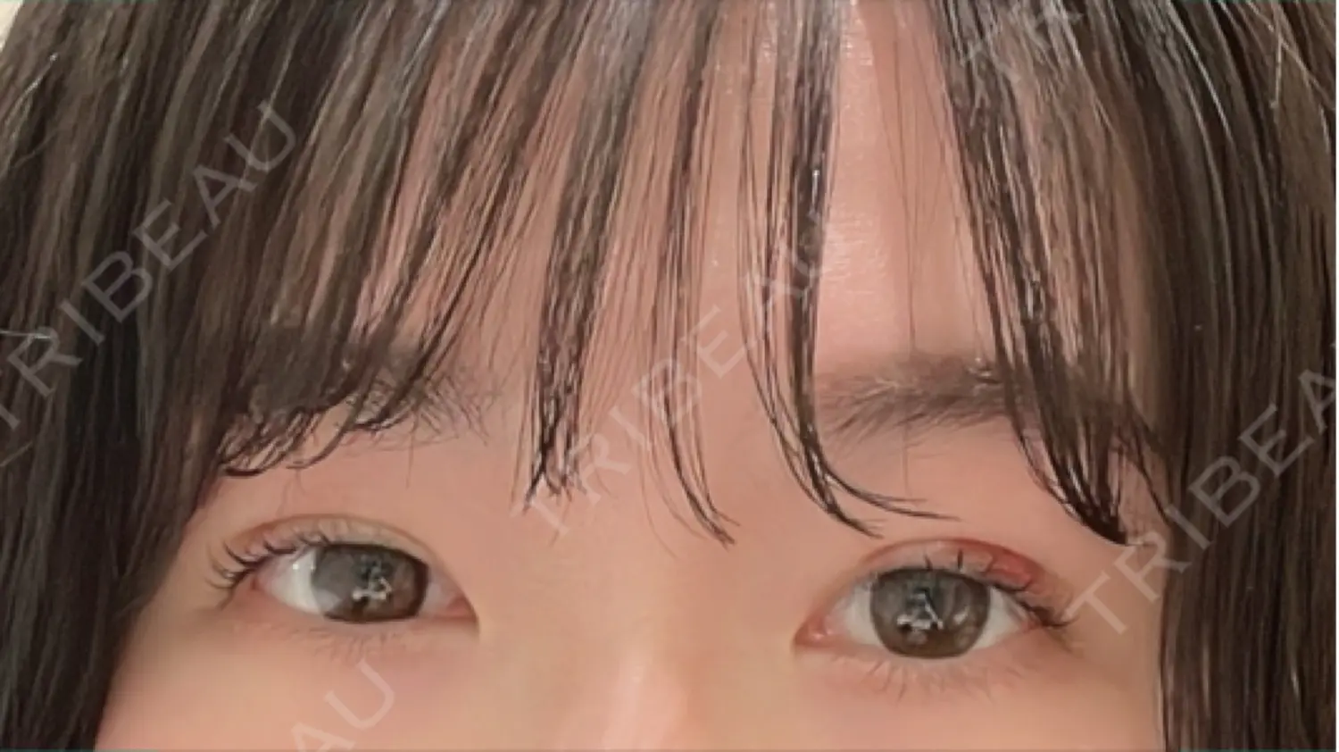 施術後の写真