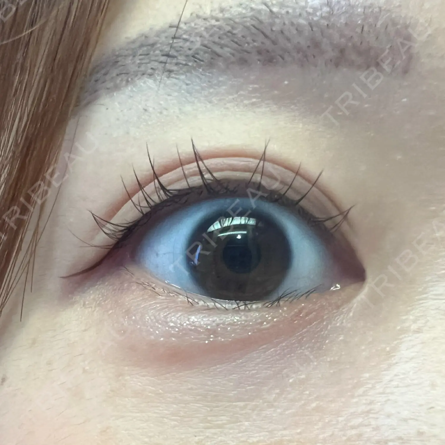 施術後の写真