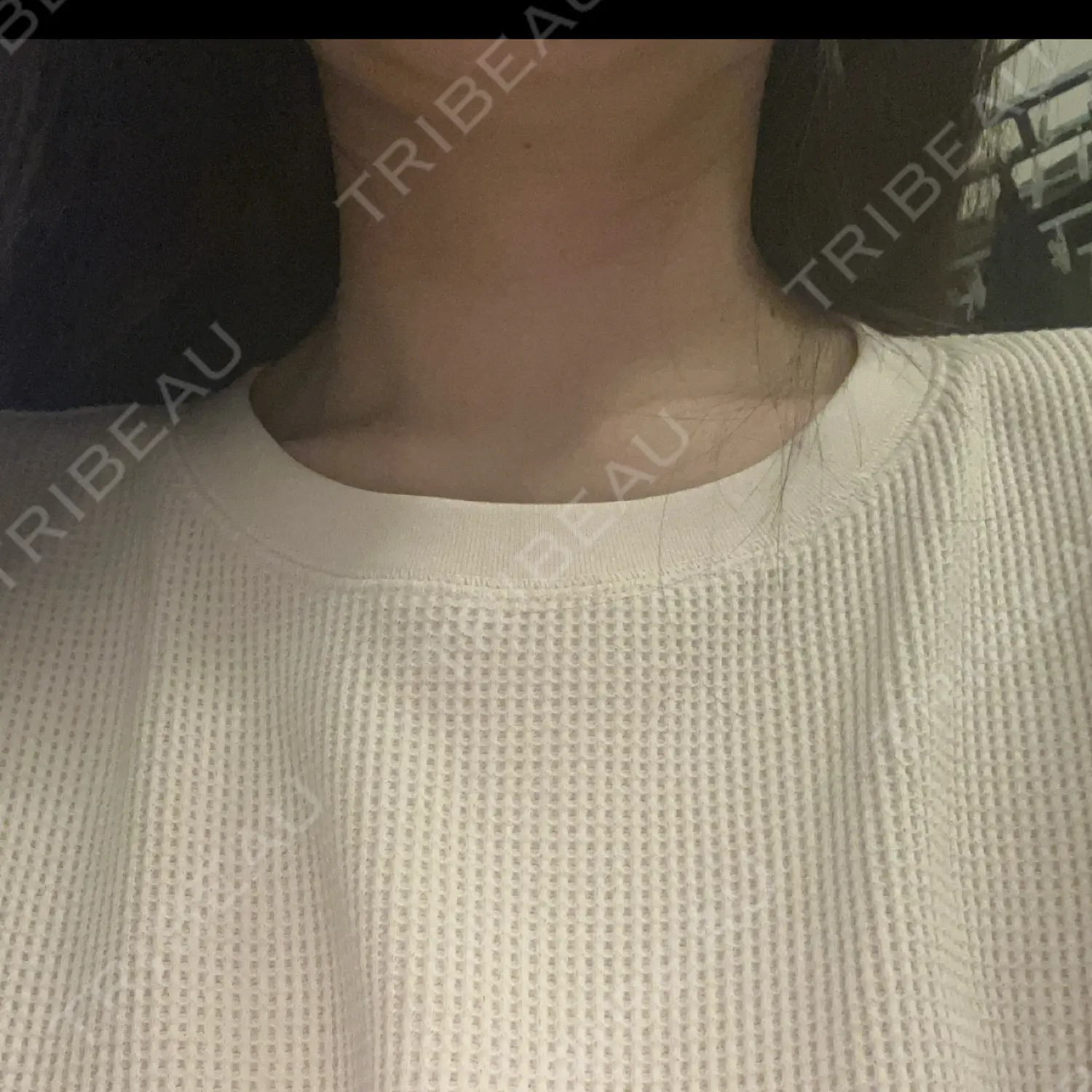 施術後の写真