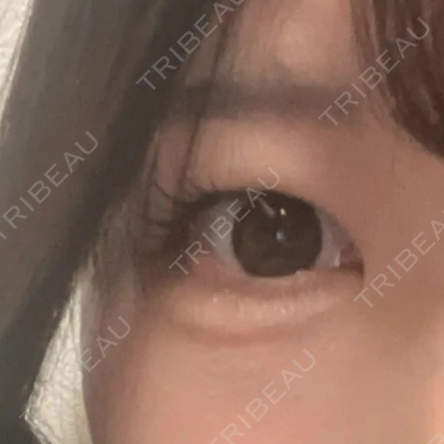 施術後の写真