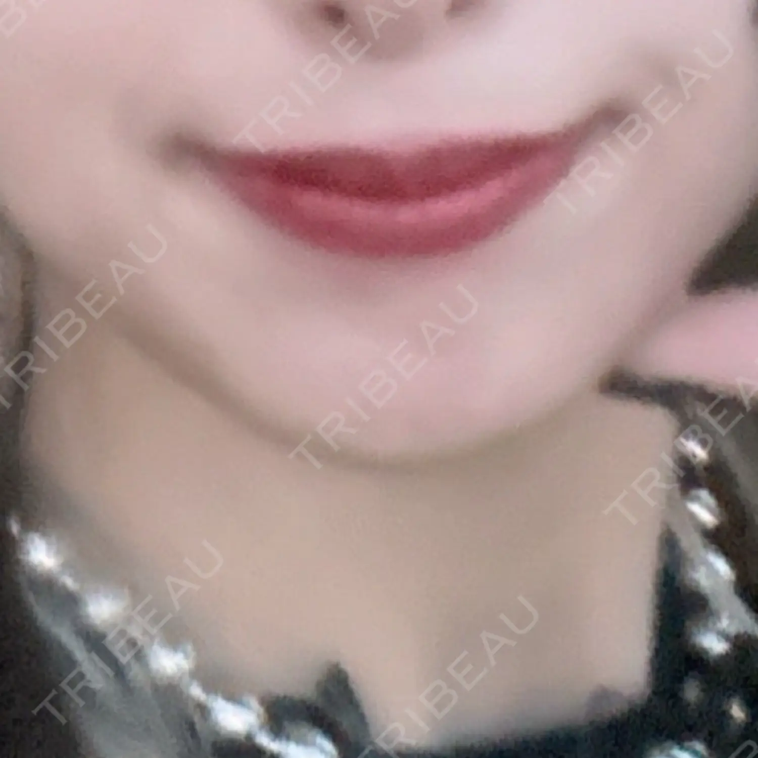 施術後の写真