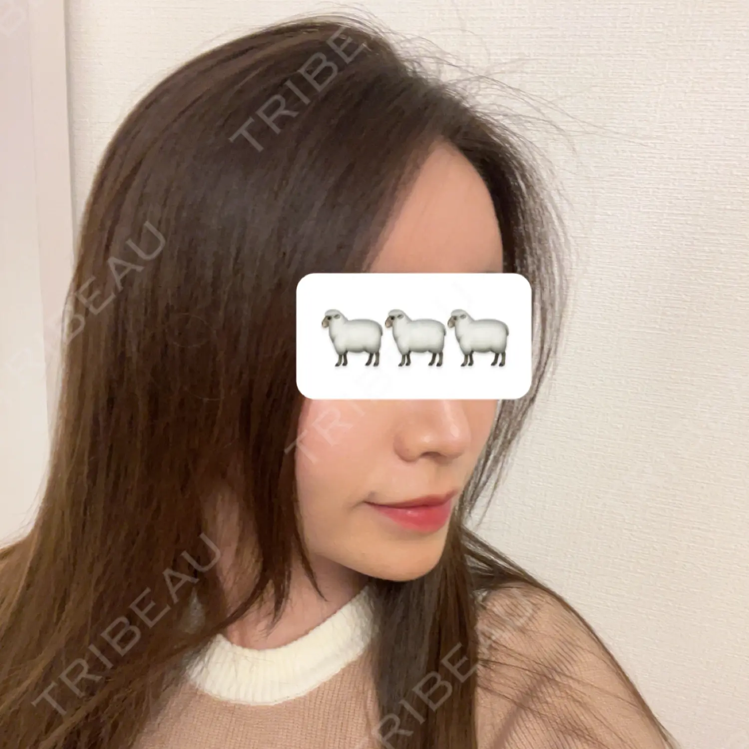 施術後の写真