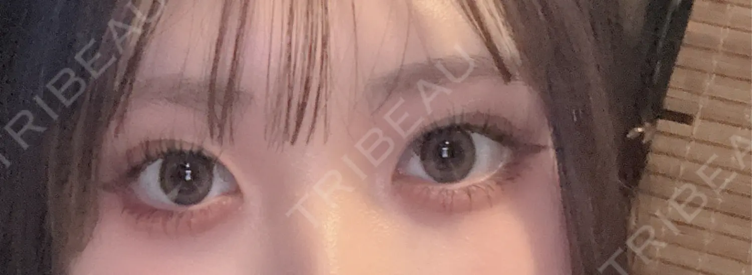 施術後の写真