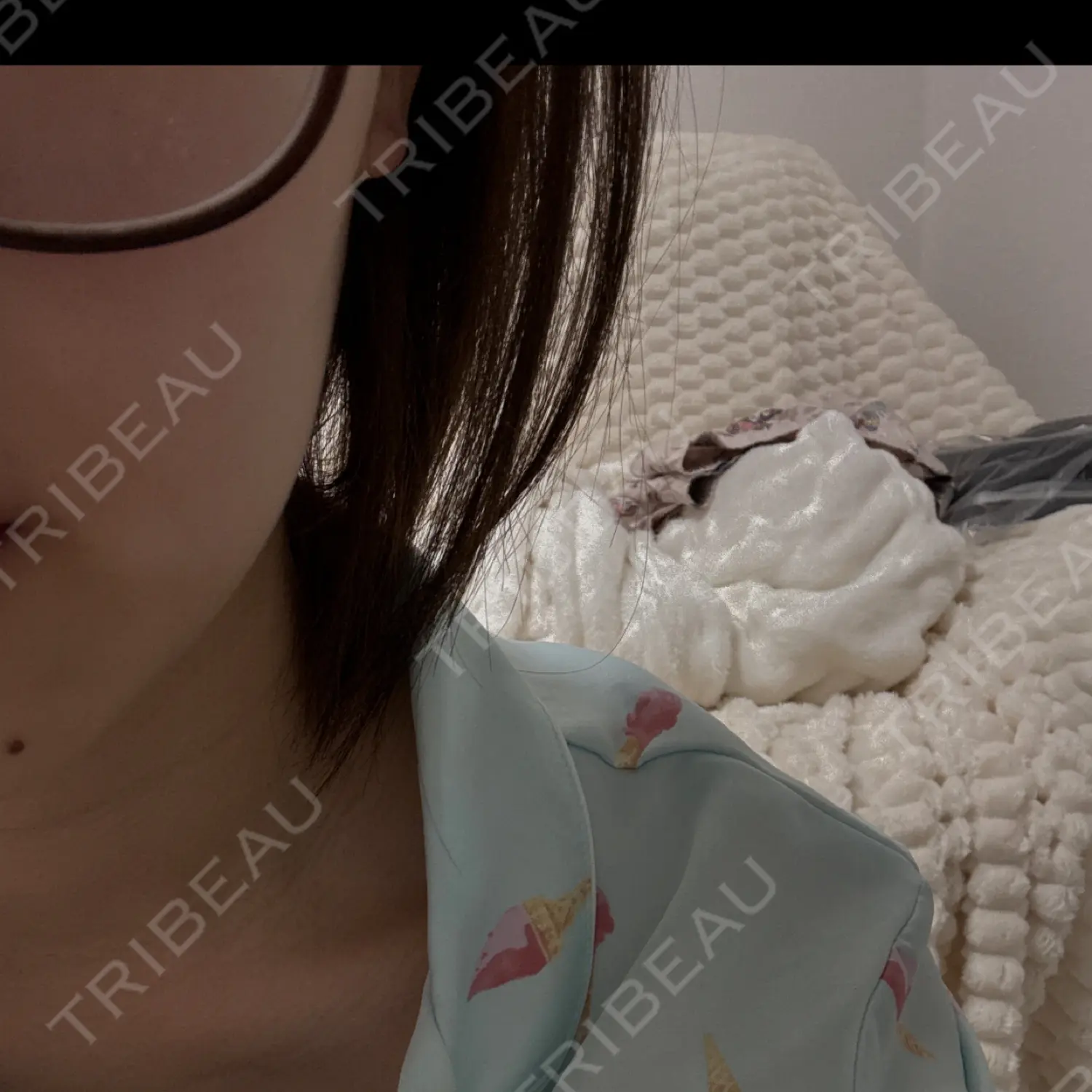施術後の写真