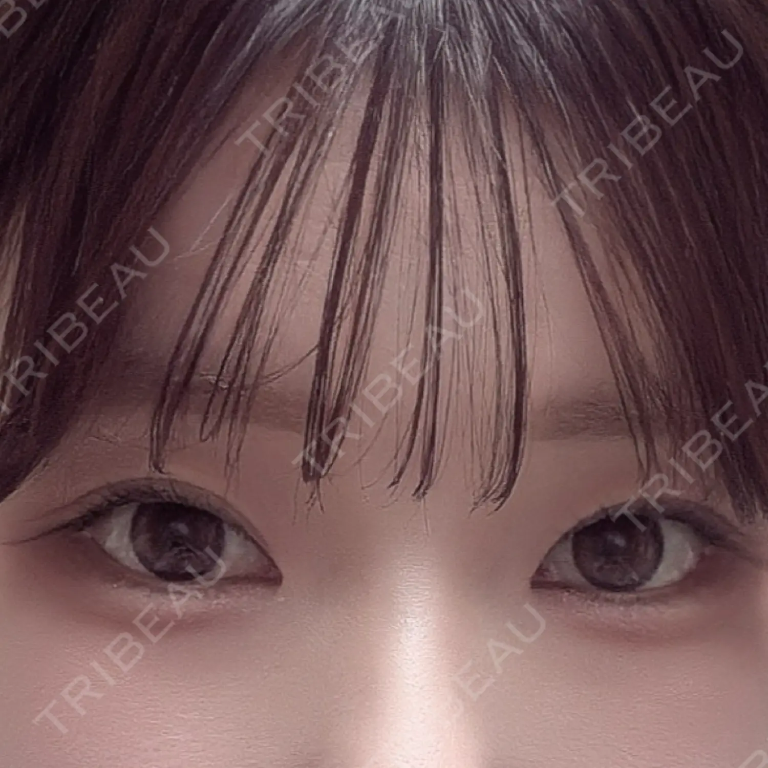 施術後の写真