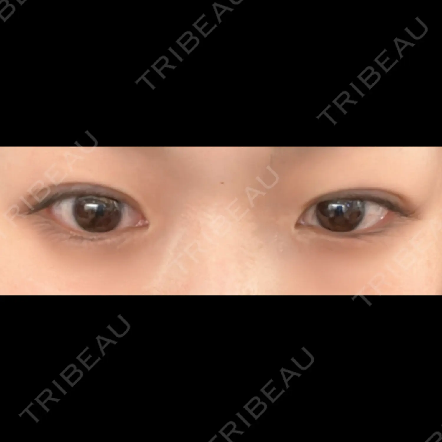 施術後の写真