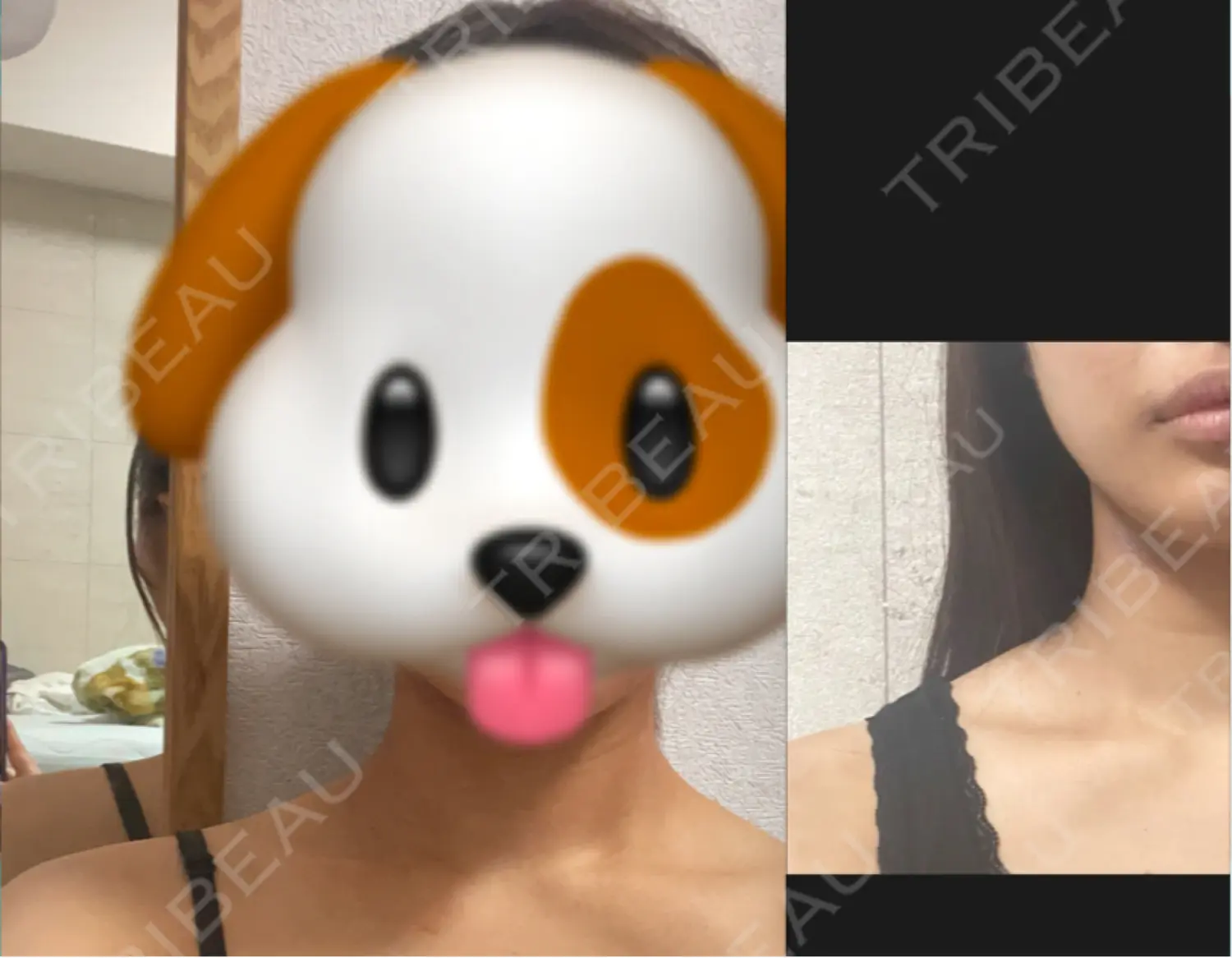 施術後の写真