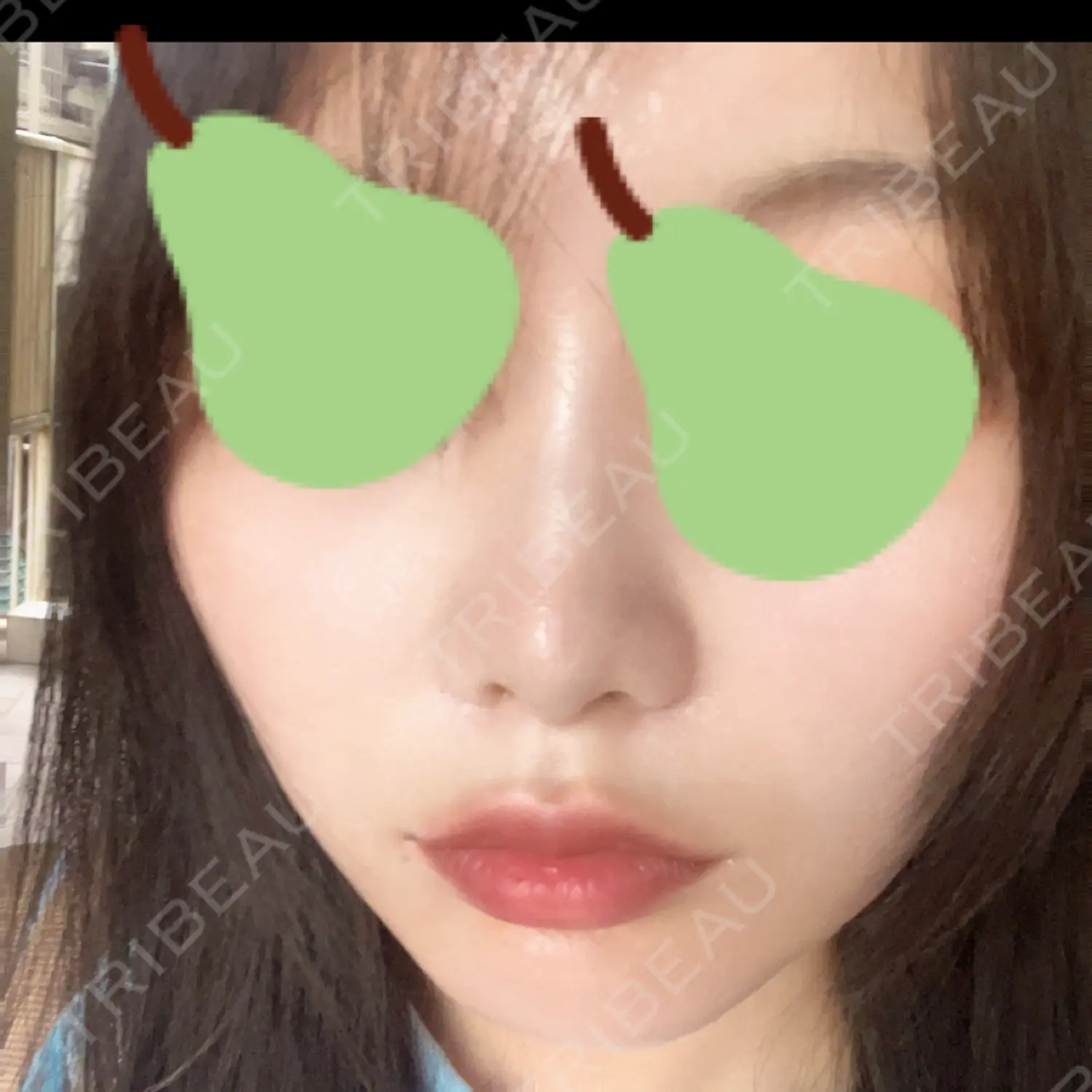 施術後の写真
