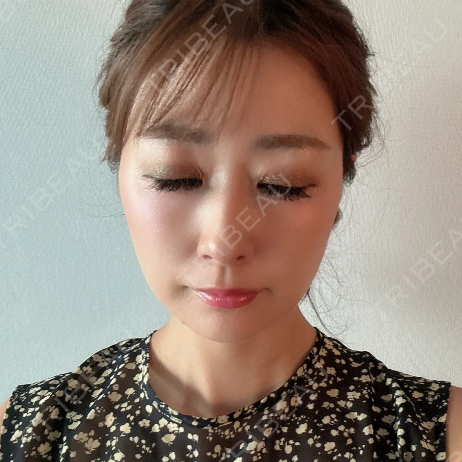 施術後の写真
