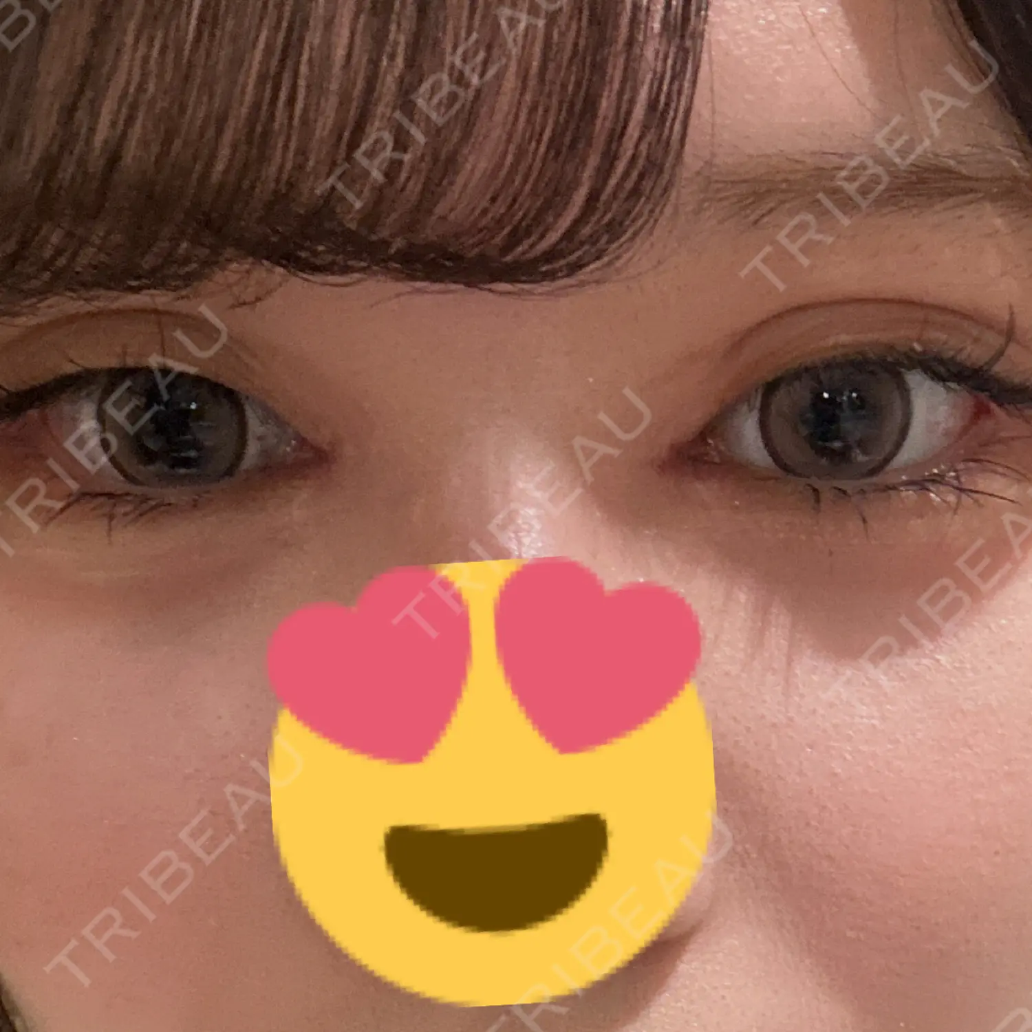 施術後の写真