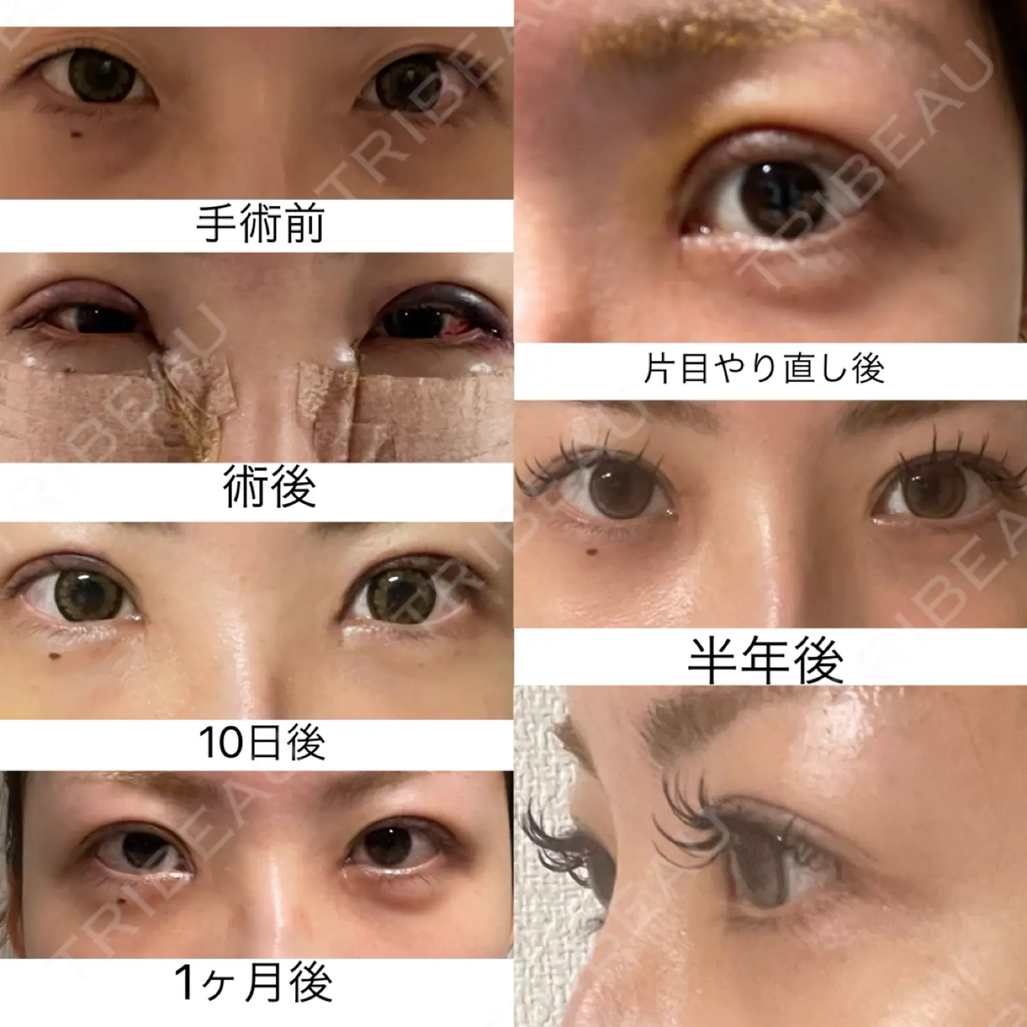 施術後の写真