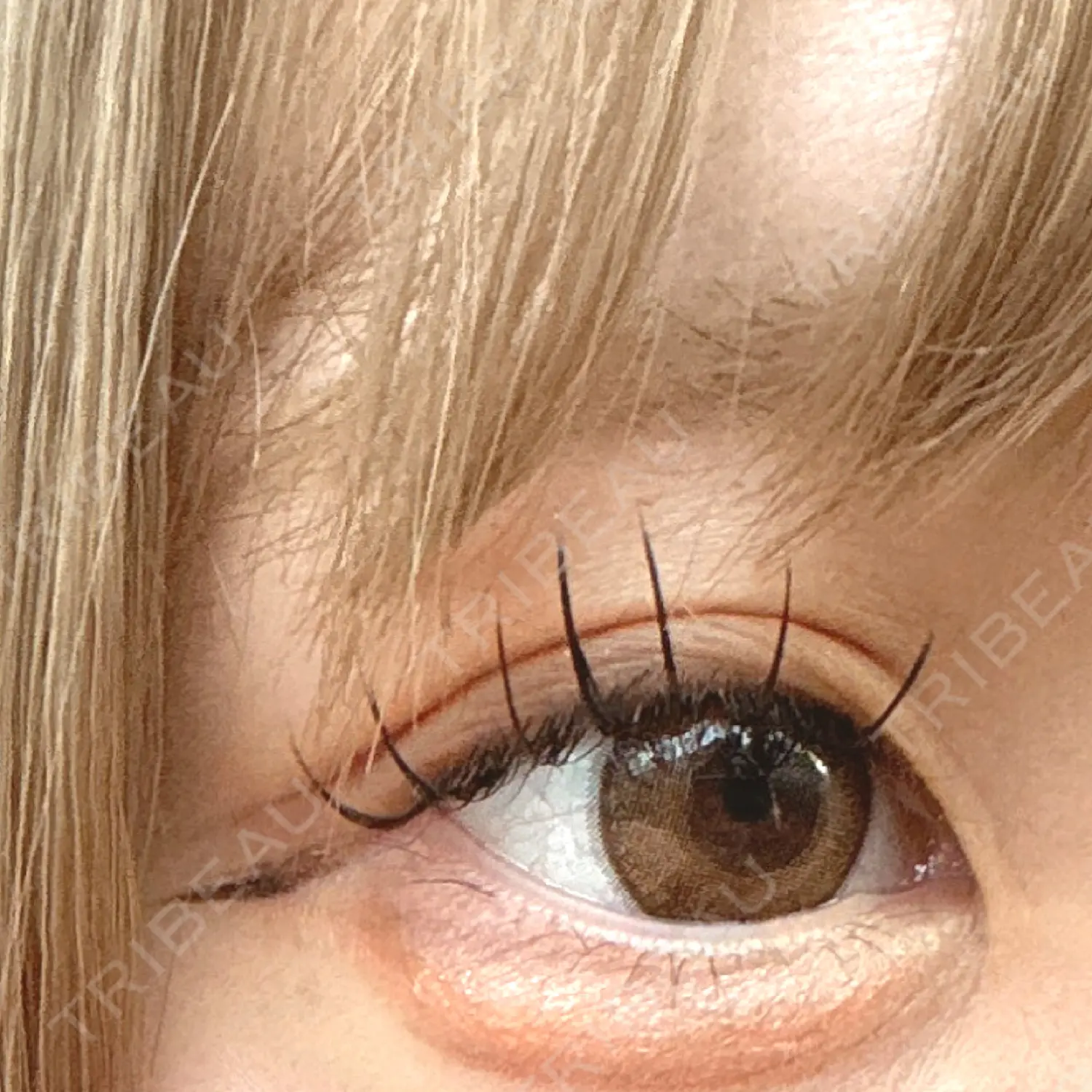 施術後の写真