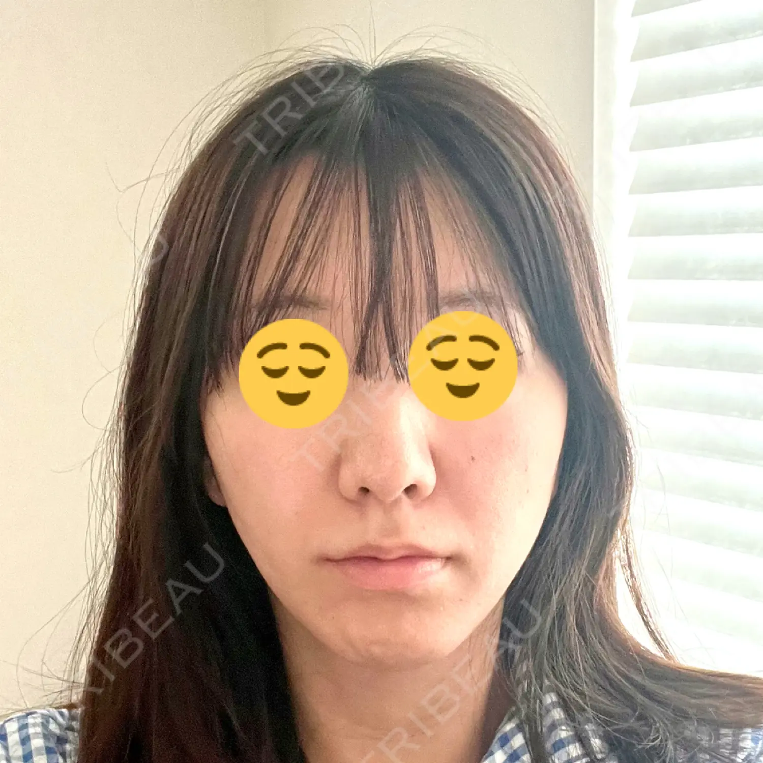 施術後の写真