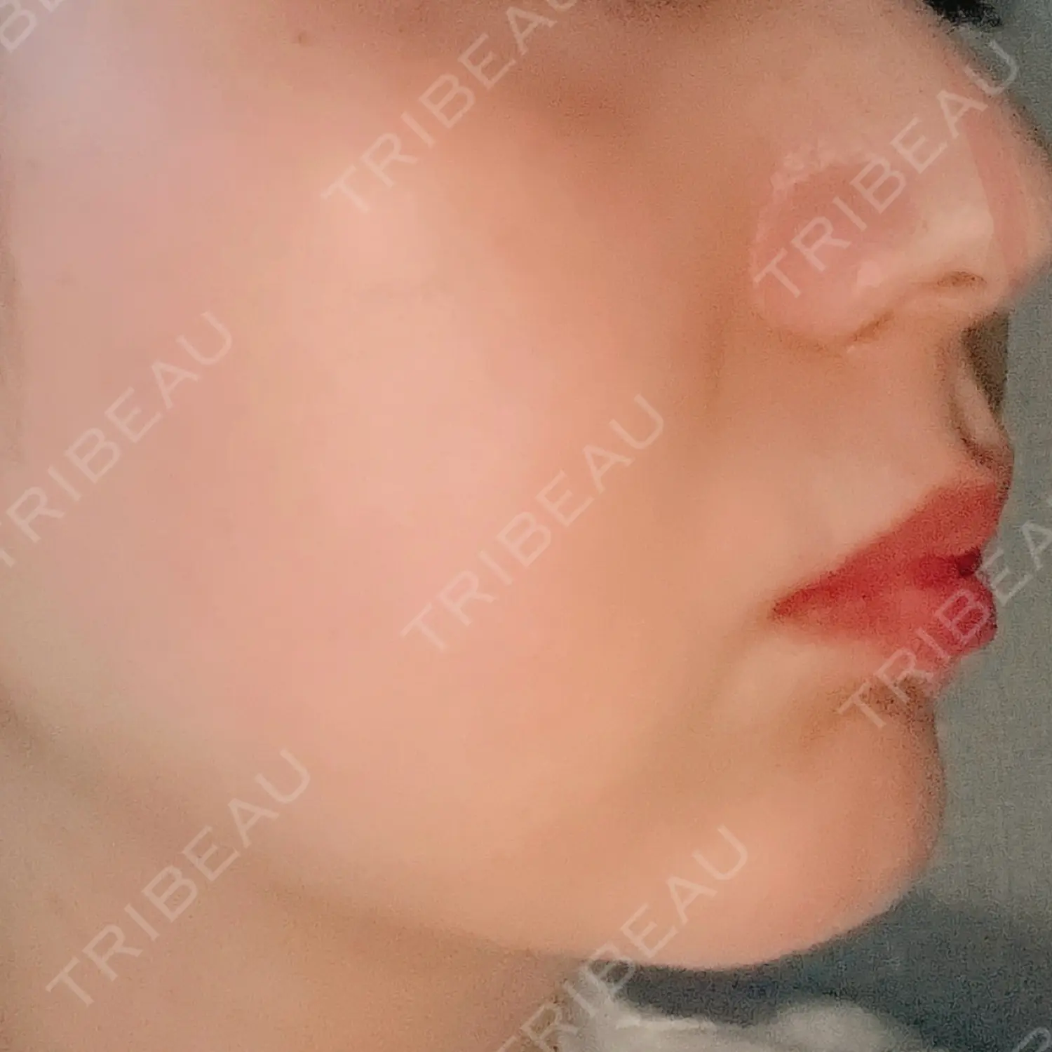 施術後の写真