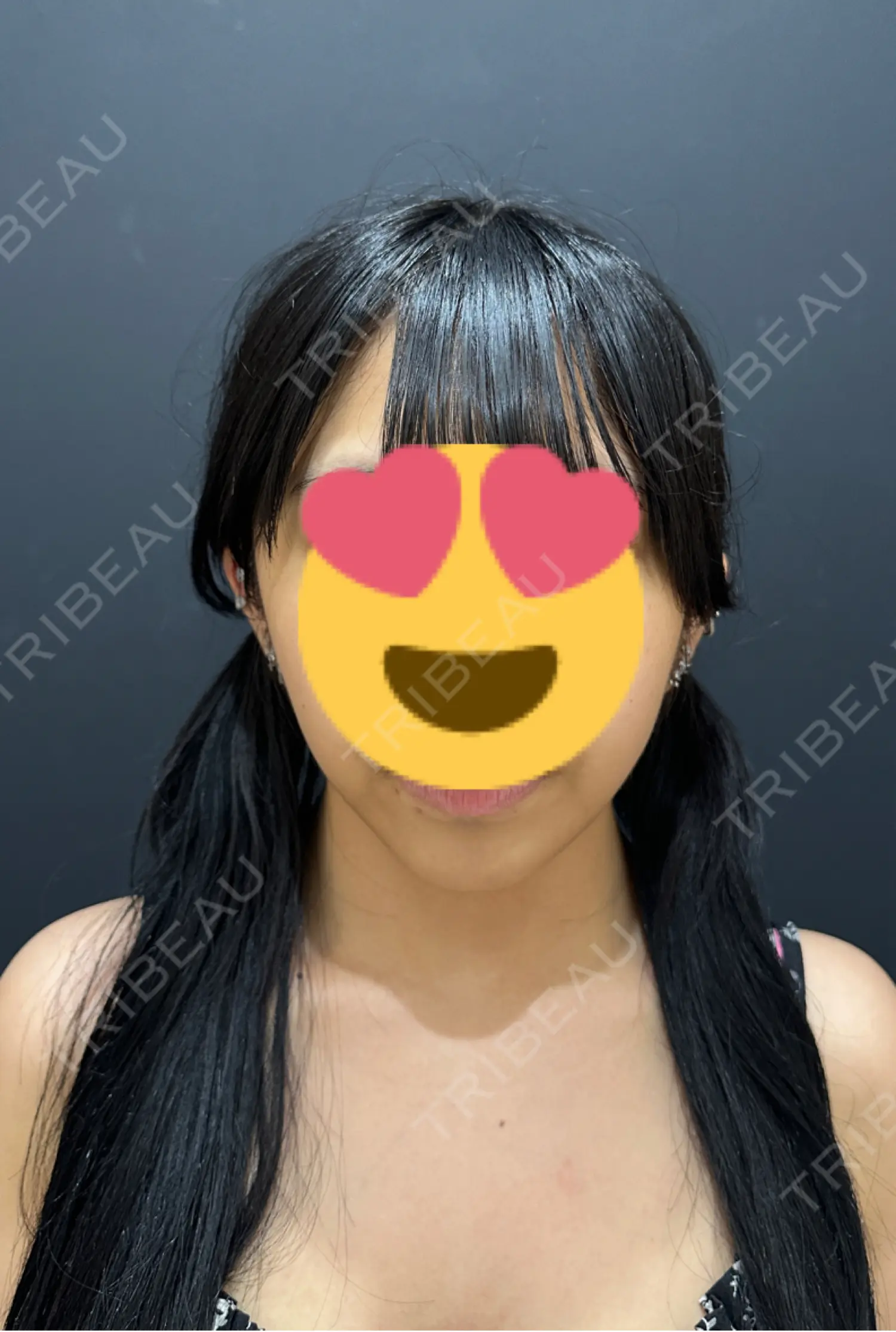 施術後の写真