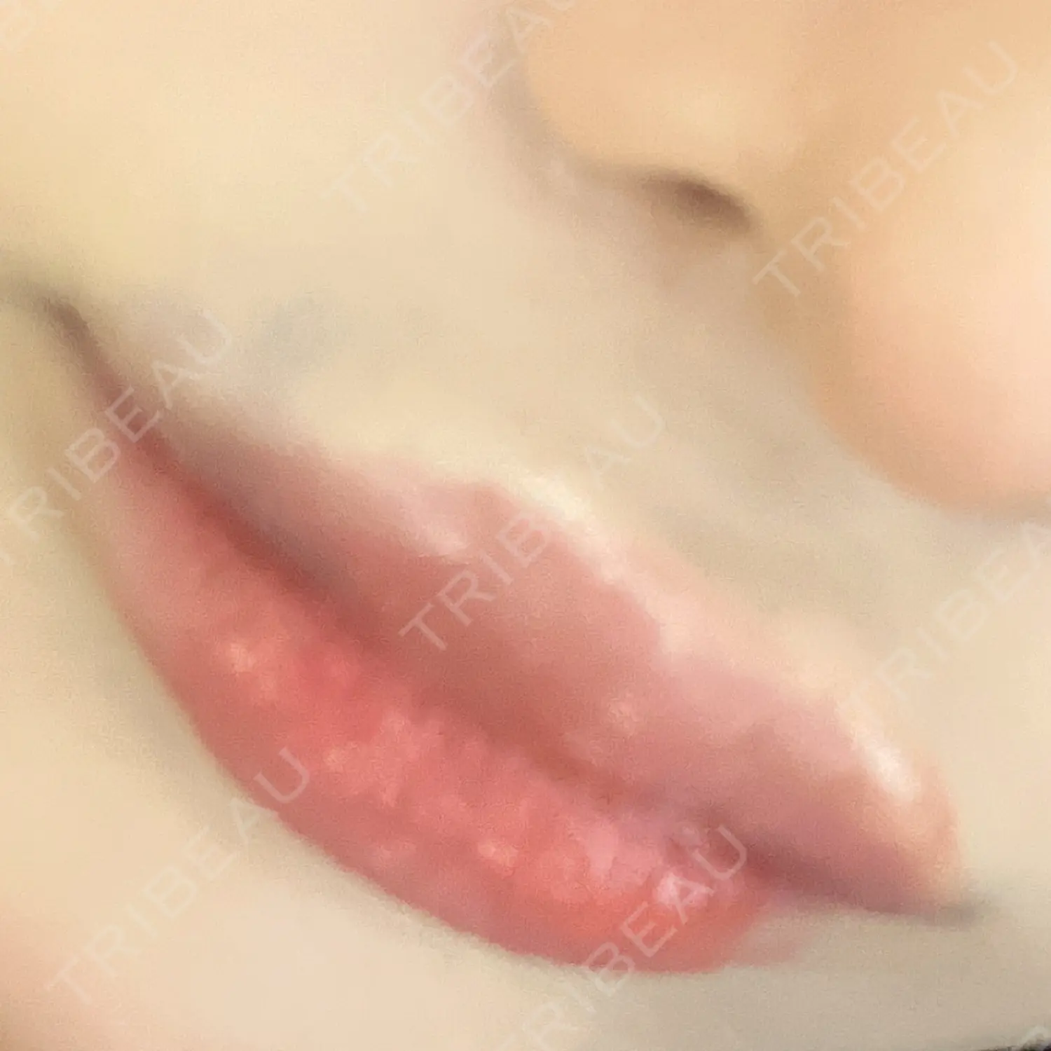 施術後の写真