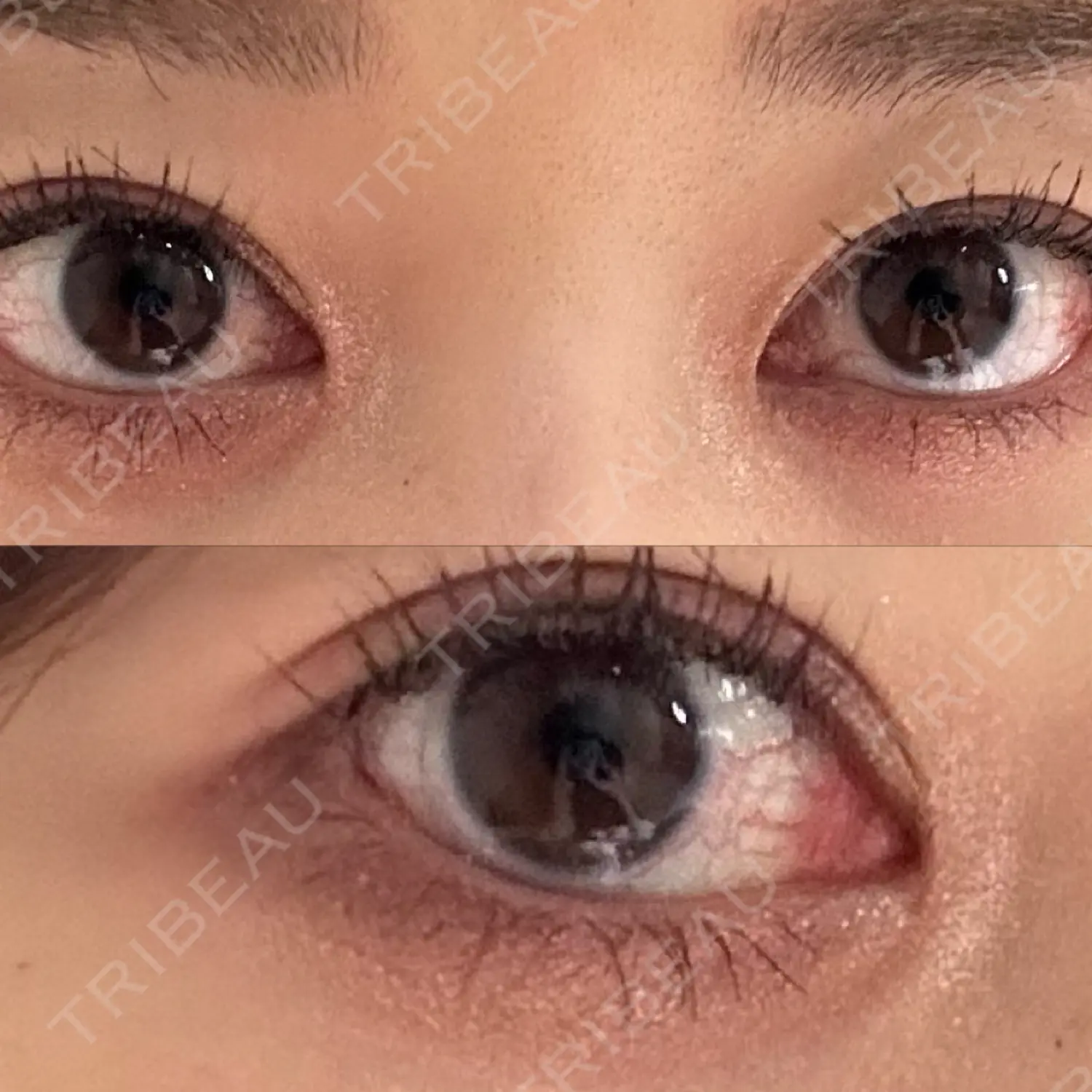 施術後の写真