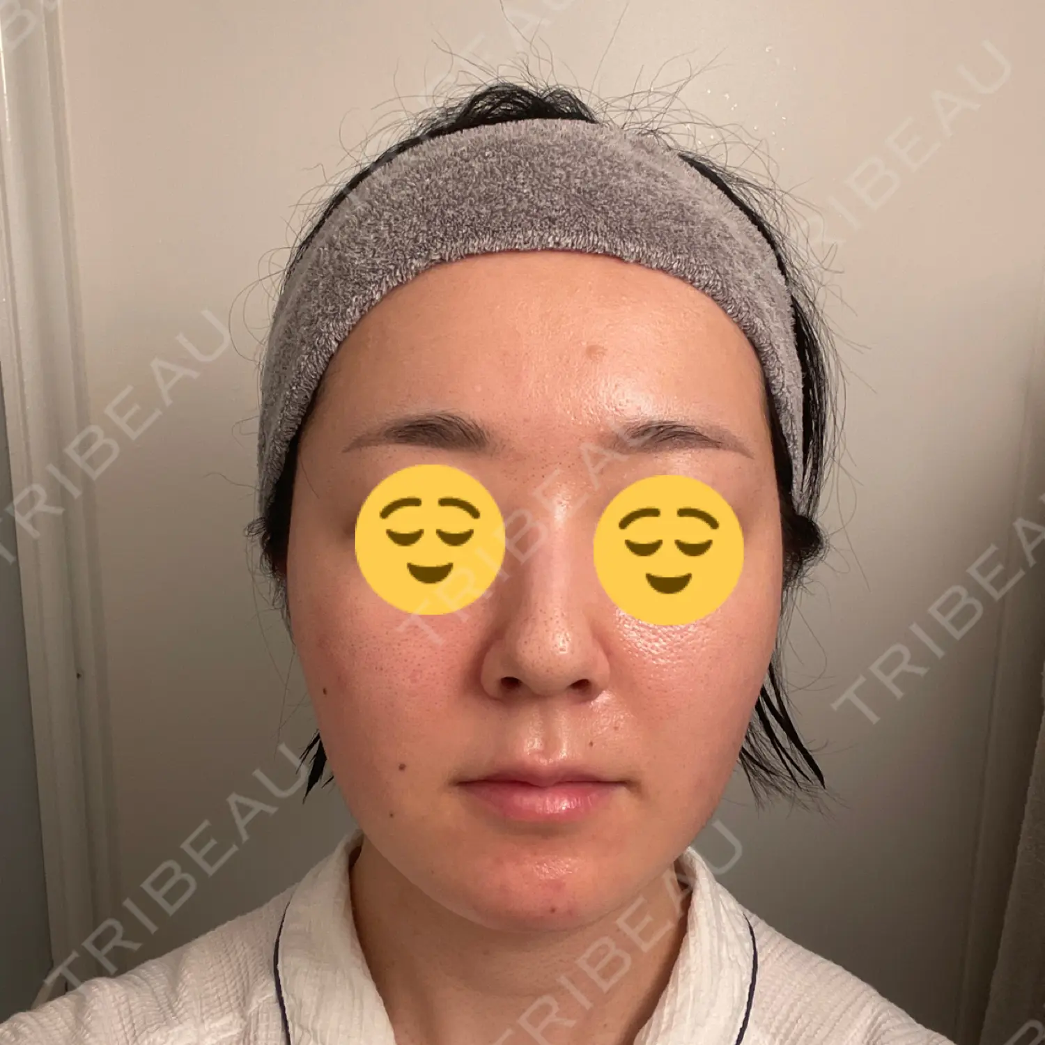 施術後の写真