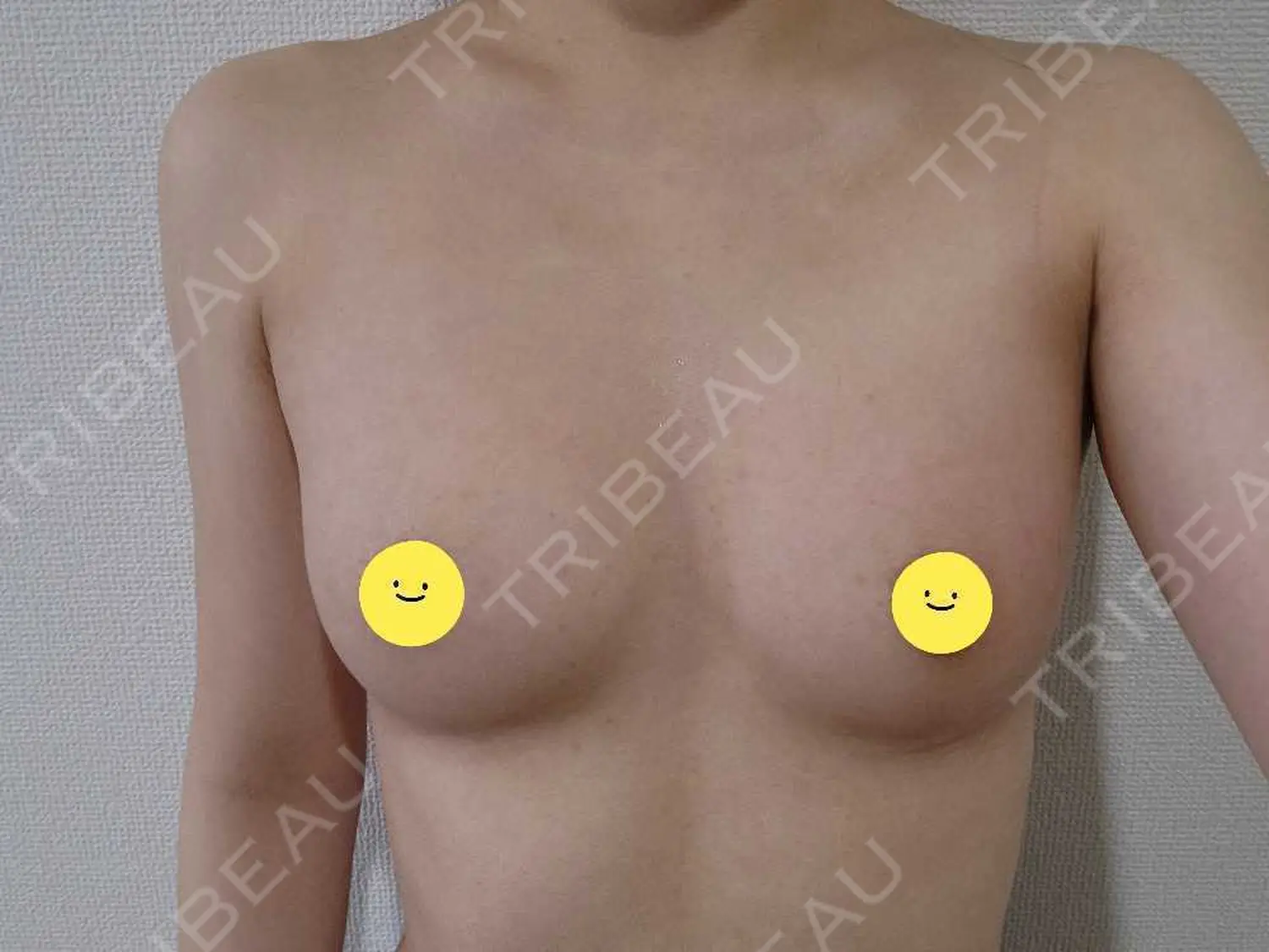 施術後の写真