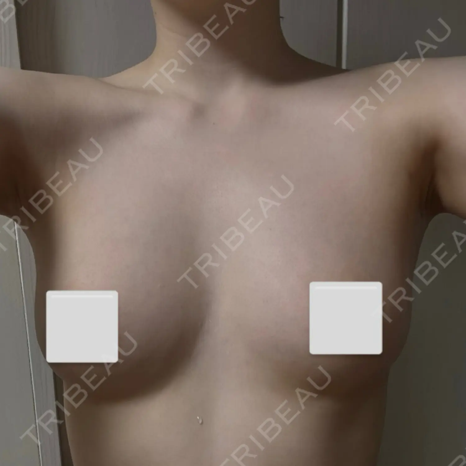 施術後の写真